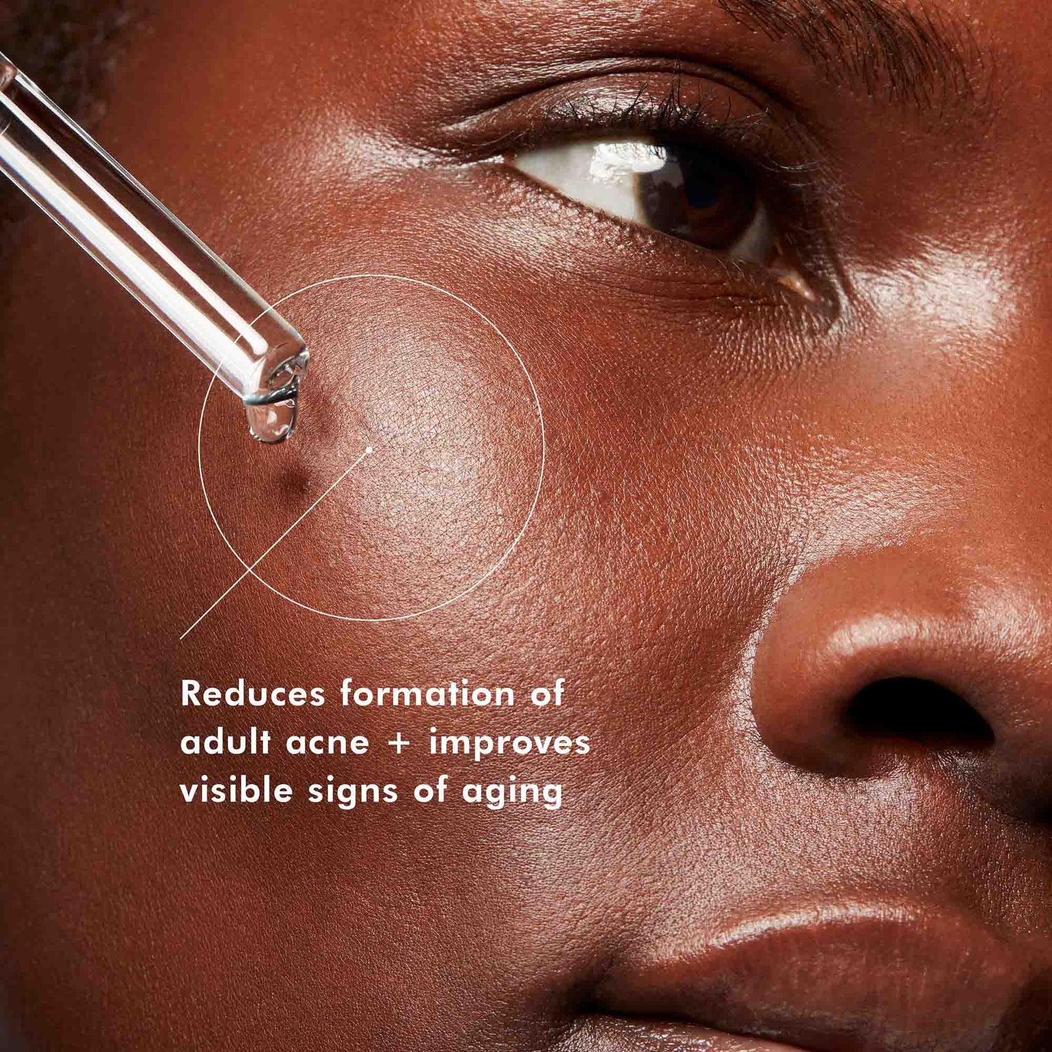 Information related to SkinCeuticals Blemish + Age Defense