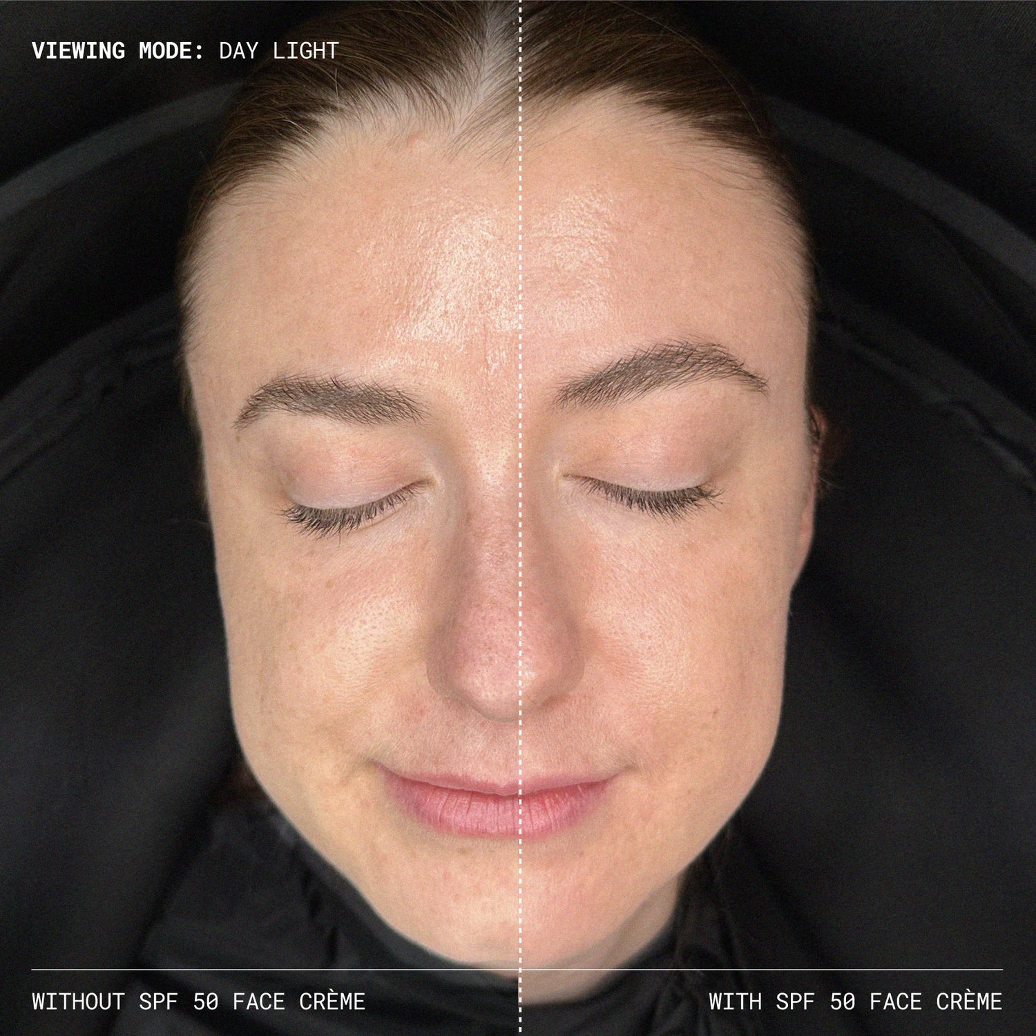 Before and after results of using Emma Lewisham Sunceutical SPF 50 Mineral Face Cream