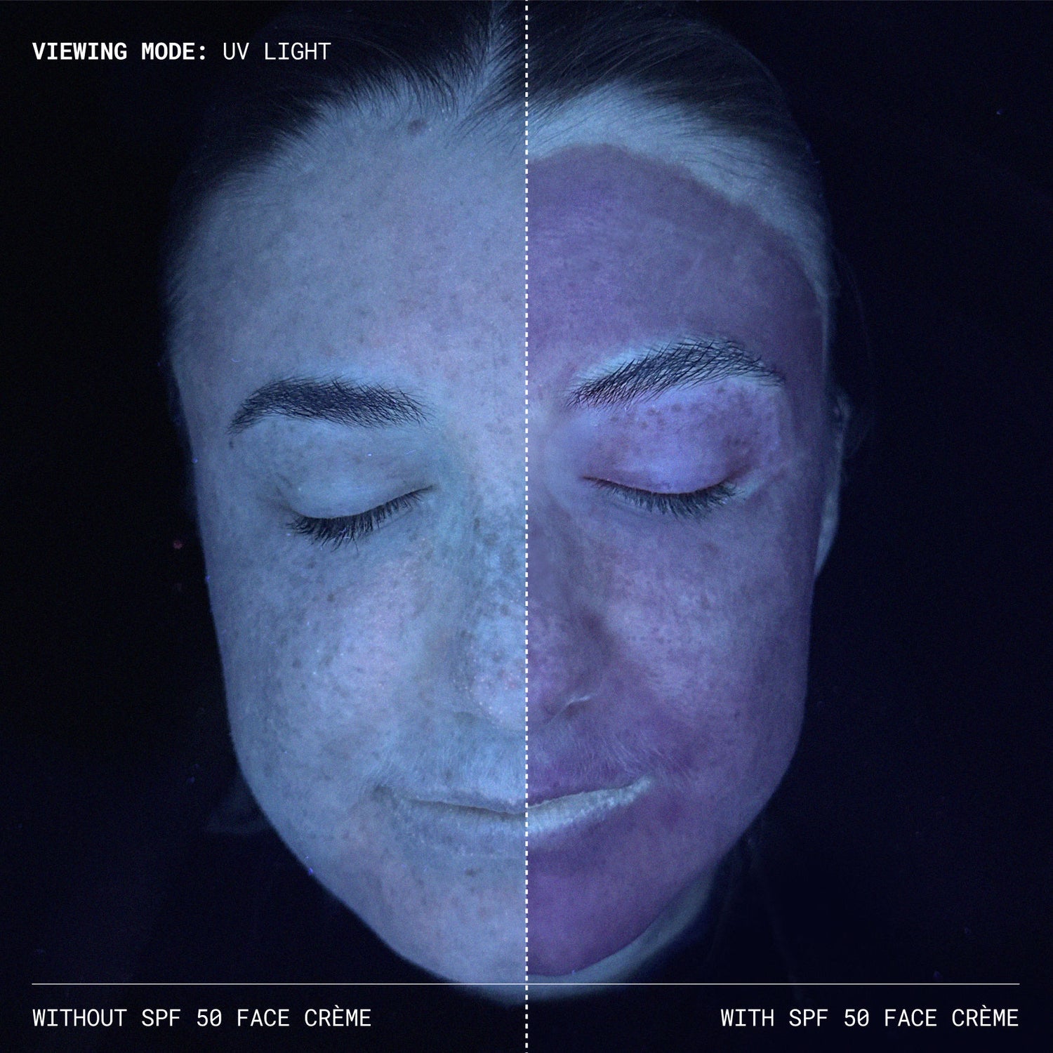 Before and after results of using Emma Lewisham Sunceutical SPF 50 Mineral Face Cream