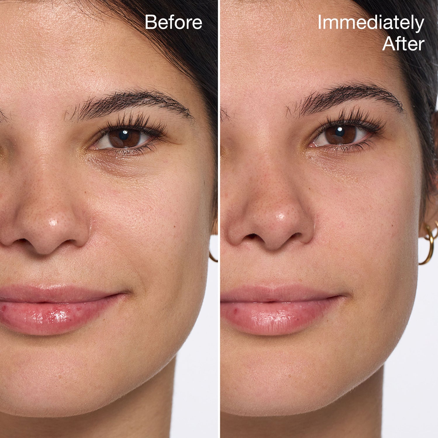 Before and after results of using Clinique All About Eyes variant: .5 oz