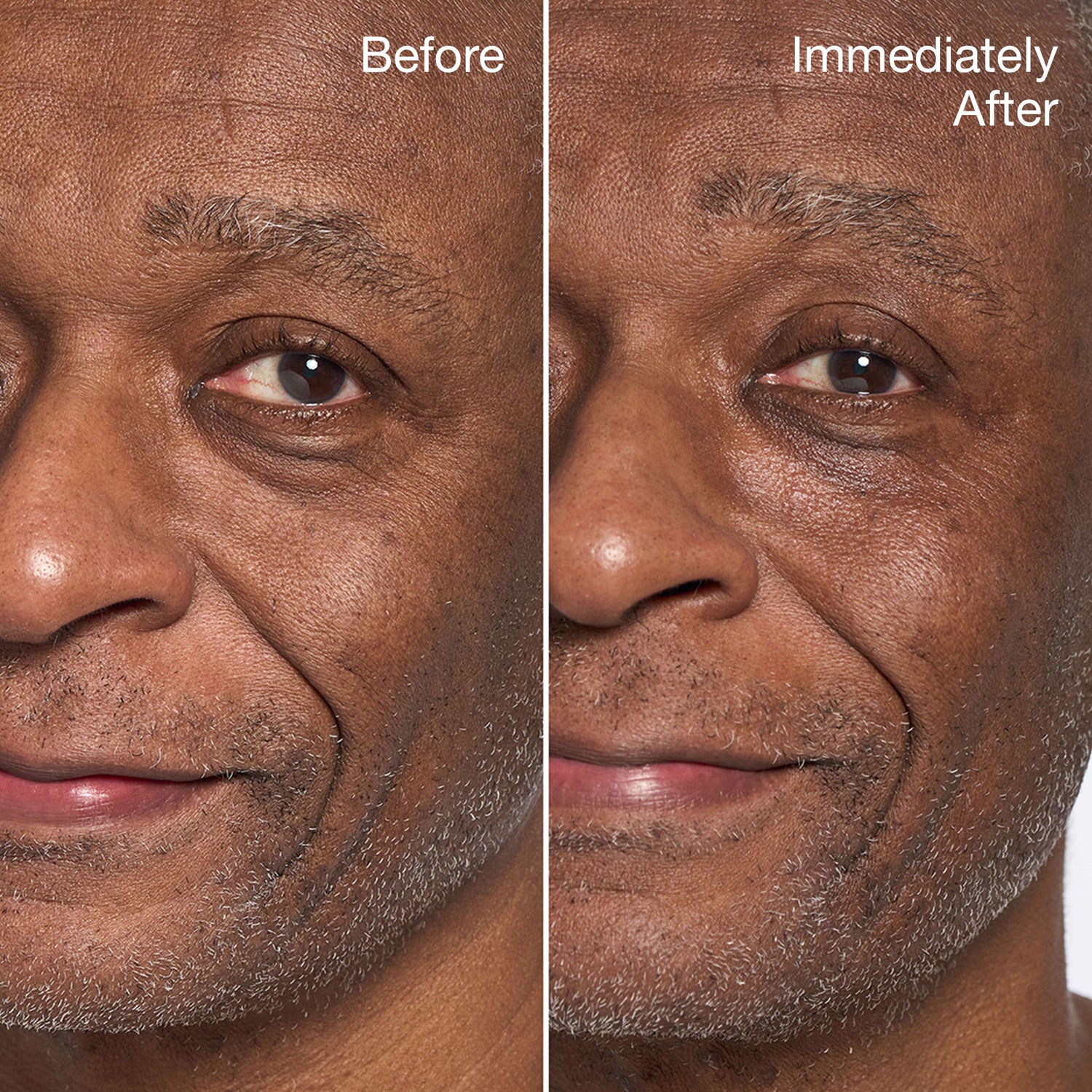 Before and after results of using Clinique All About Eyes Rich Eye Cream variant: 0.5 oz