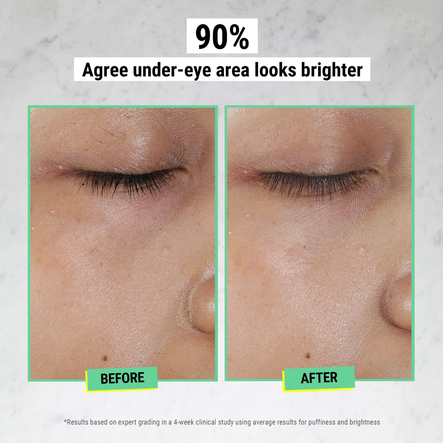 Before and after results of using Kiehl's Since 1851 Creamy Eye Treatment With Avocado variant: 0.95 oz