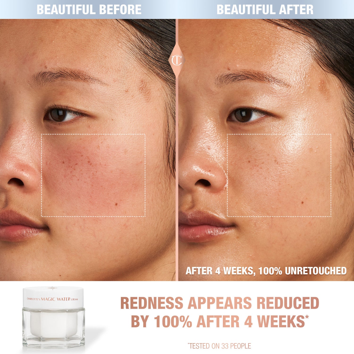 Before and after results of using Charlotte Tilbury 1 oz variant: 1 oz