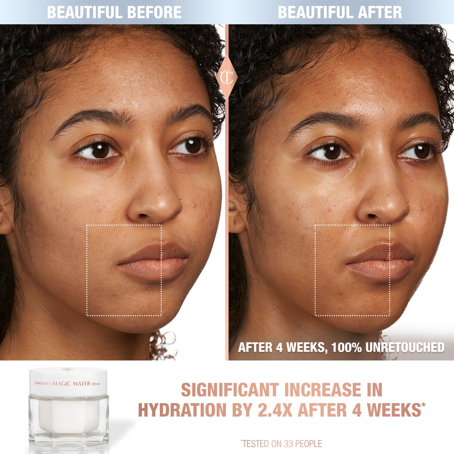 Before and after results of using Charlotte Tilbury 1 oz variant: 1 oz