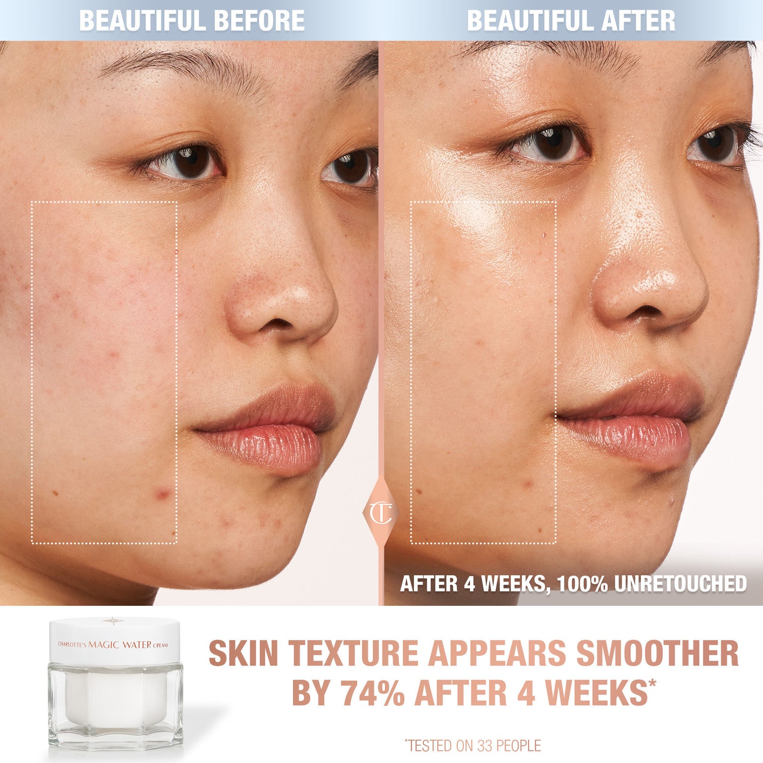 Before and after results of using Charlotte Tilbury 1 oz variant: 1 oz