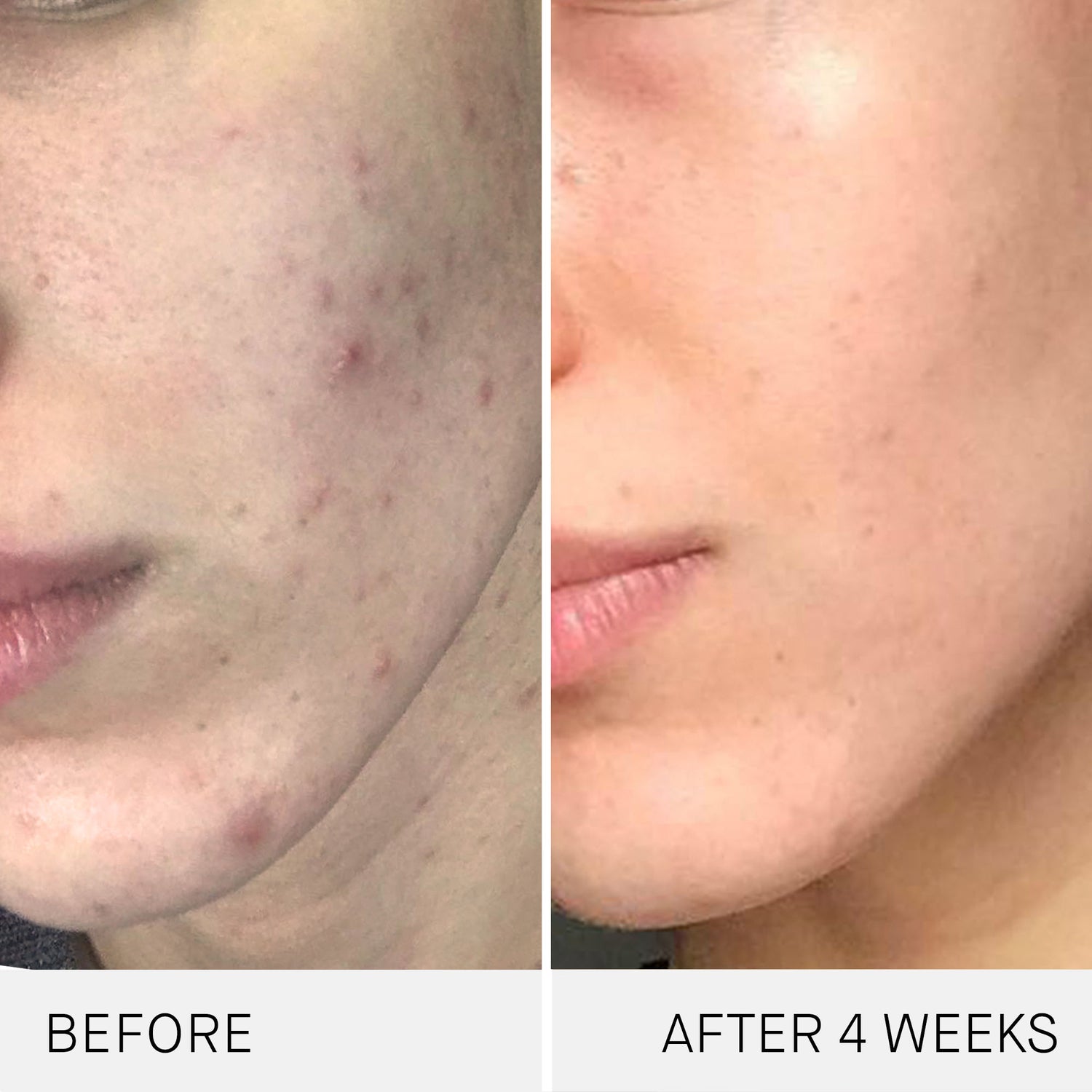 Before and after results of using Augustinus Bader The Cream variant: 1.0 fl oz