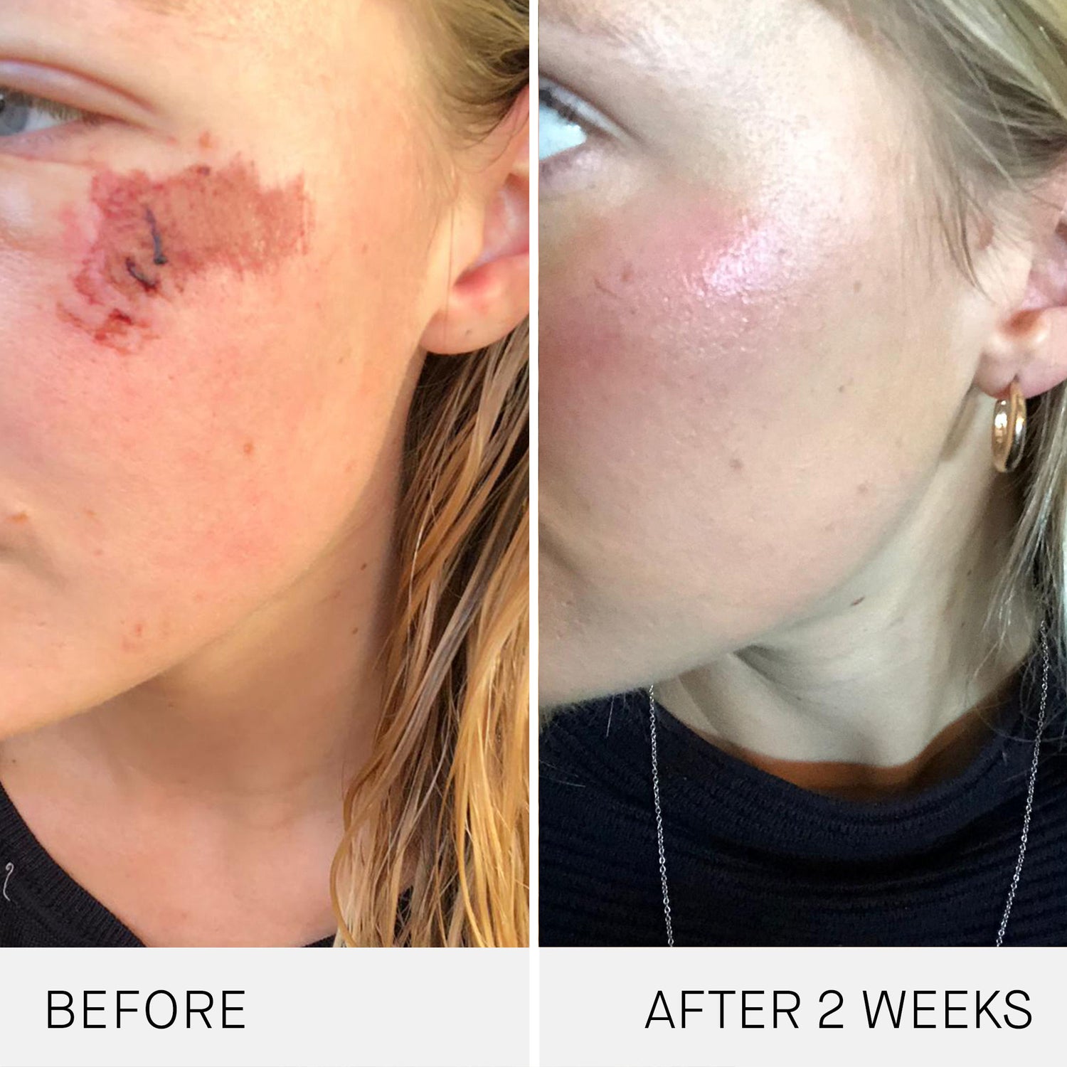Before and after results of using Augustinus Bader The Cream variant: 1.0 fl oz