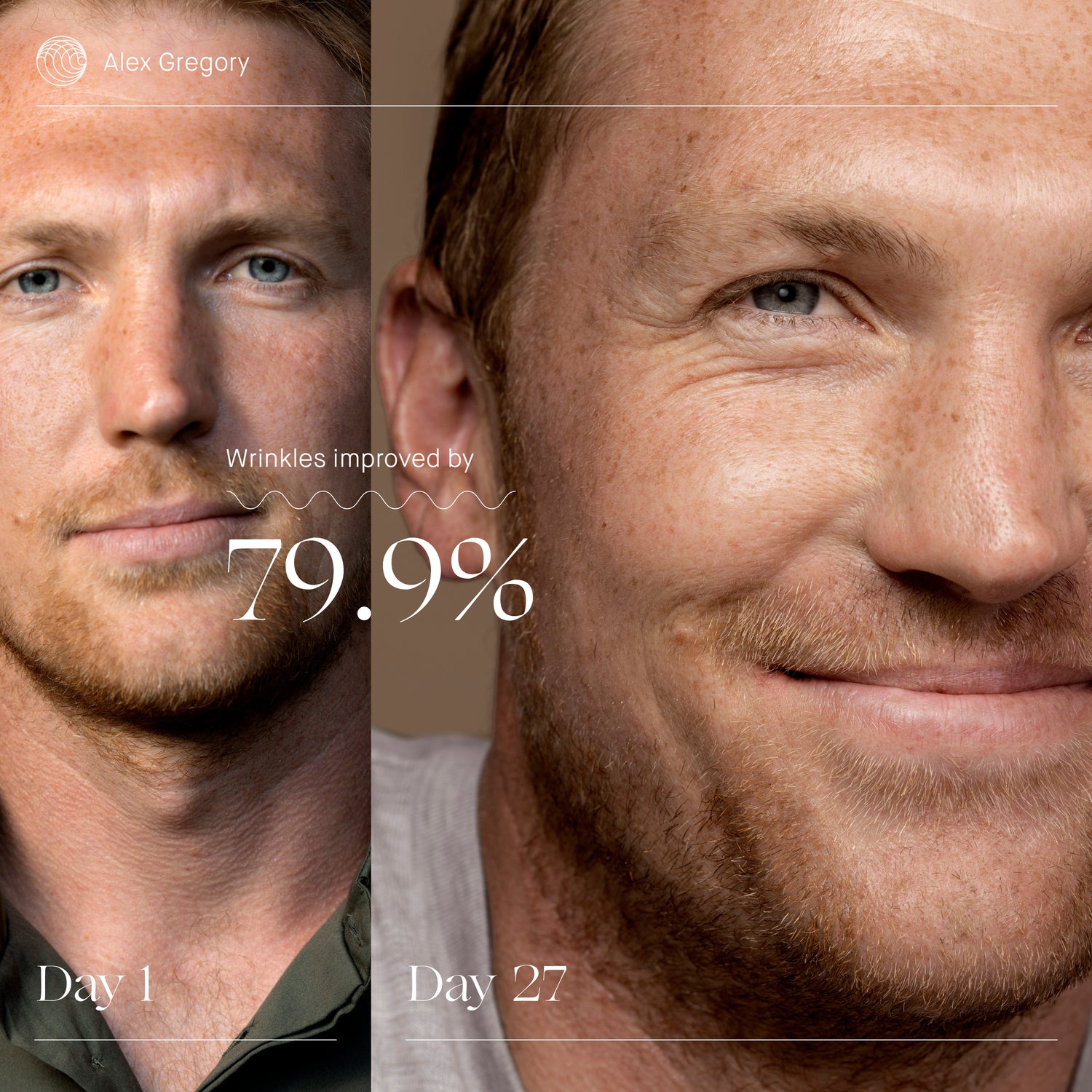 Before and after results of using Augustinus Bader The Rich Cream variant: 1 fl oz