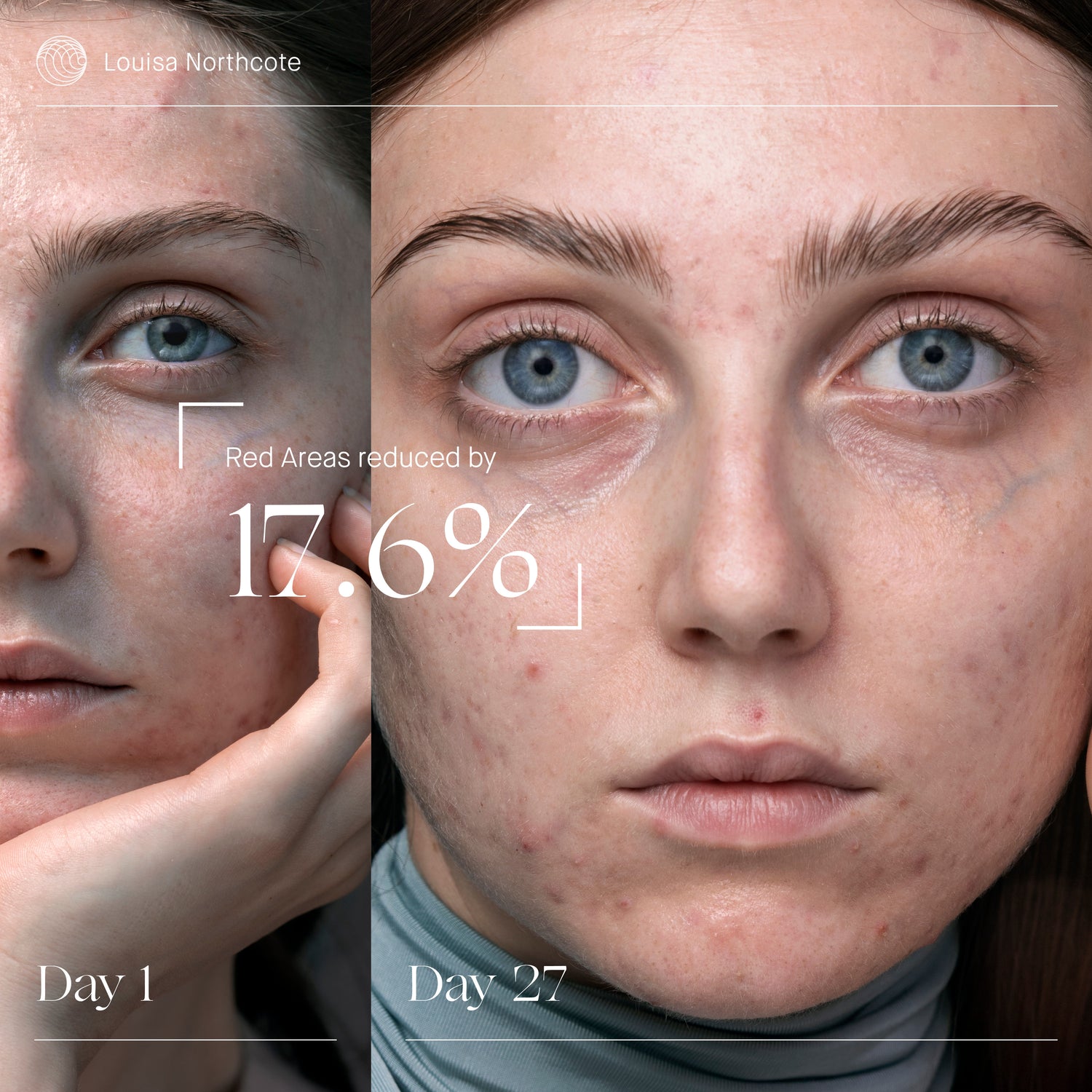 Before and after results of using Augustinus Bader The Rich Cream variant: 1 fl oz