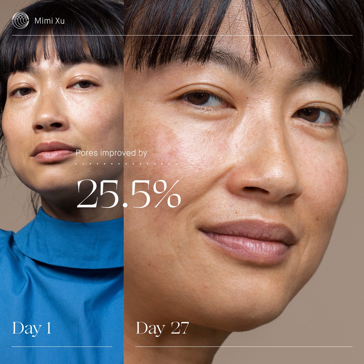 Before and after results of using Augustinus Bader The Rich Cream variant: 1 fl oz