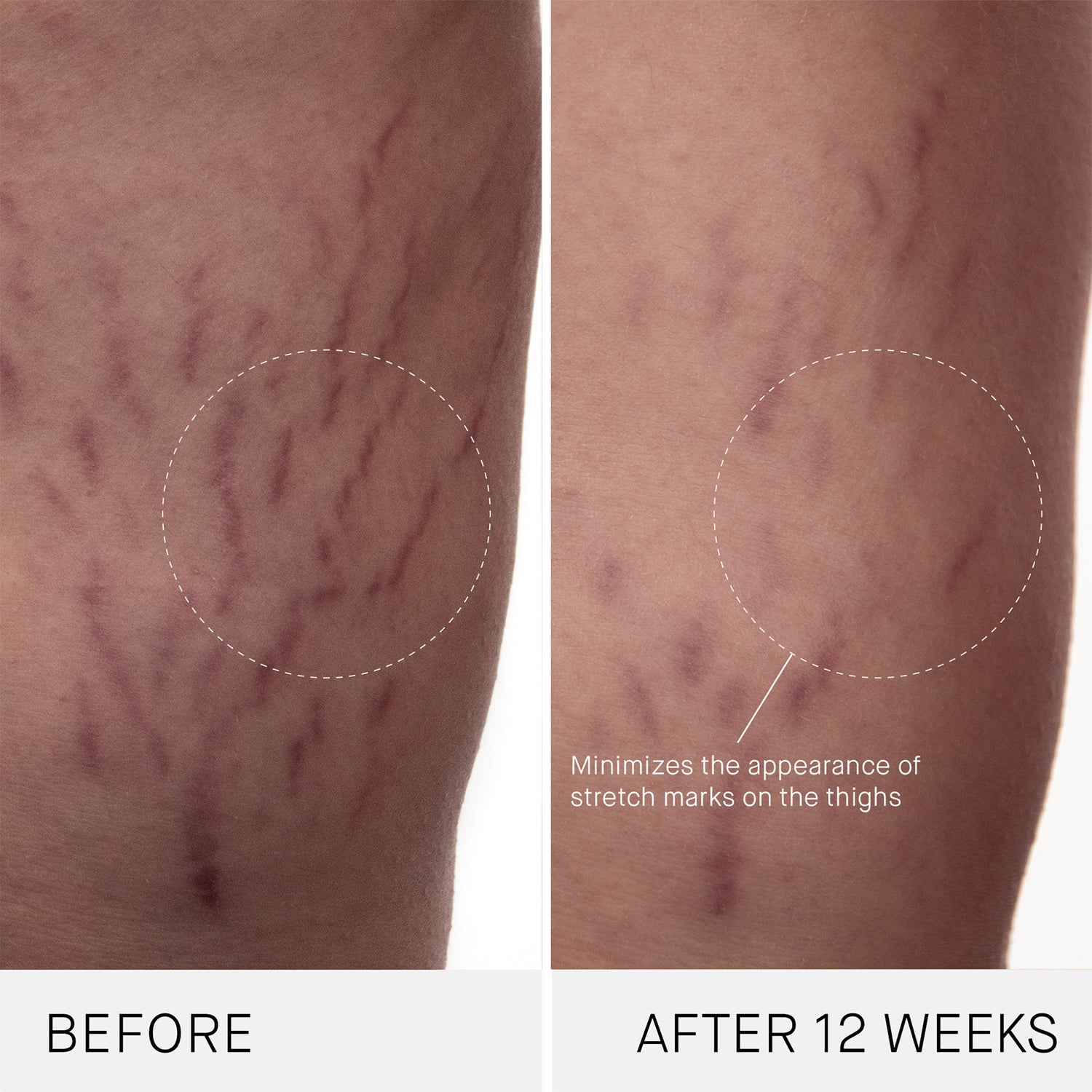 Before and after results of using Augustinus Bader The Body Cream variant: 6.7 fl oz