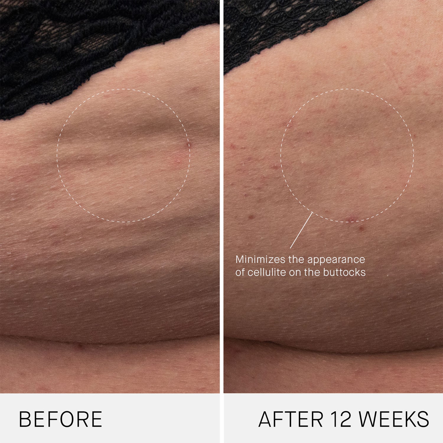 Before and after results of using Augustinus Bader The Body Cream variant: 6.7 fl oz