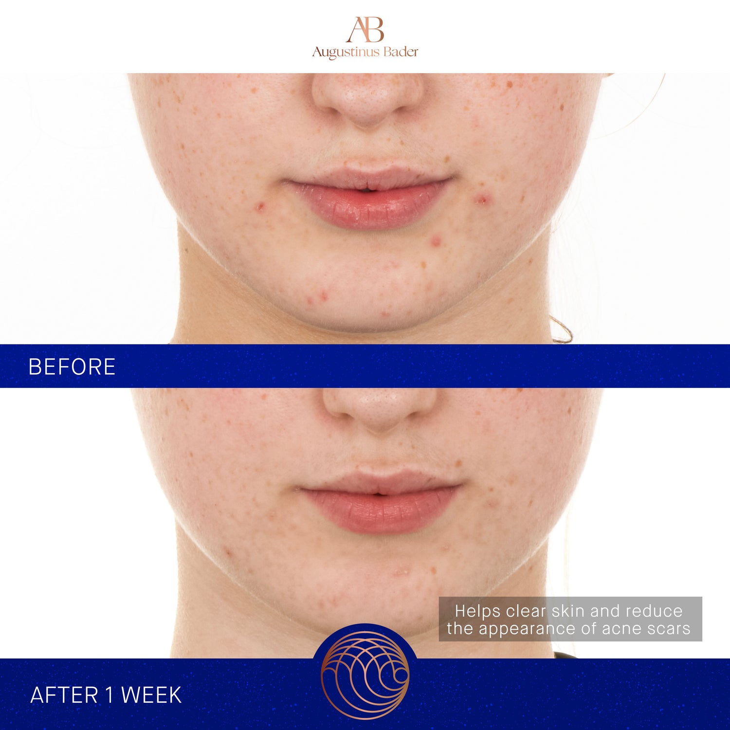 Before and after results of using Augustinus Bader The Retinol Serum variant: 1.7 oz