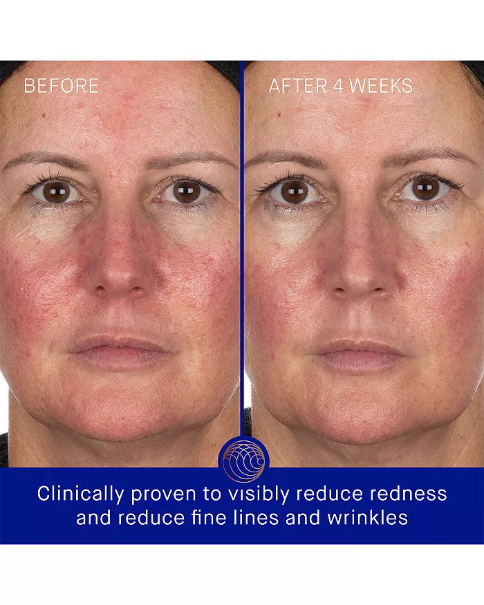 Before and after results of using Augustinus Bader The Hydrogel Face Mask variant: 1 Treatment