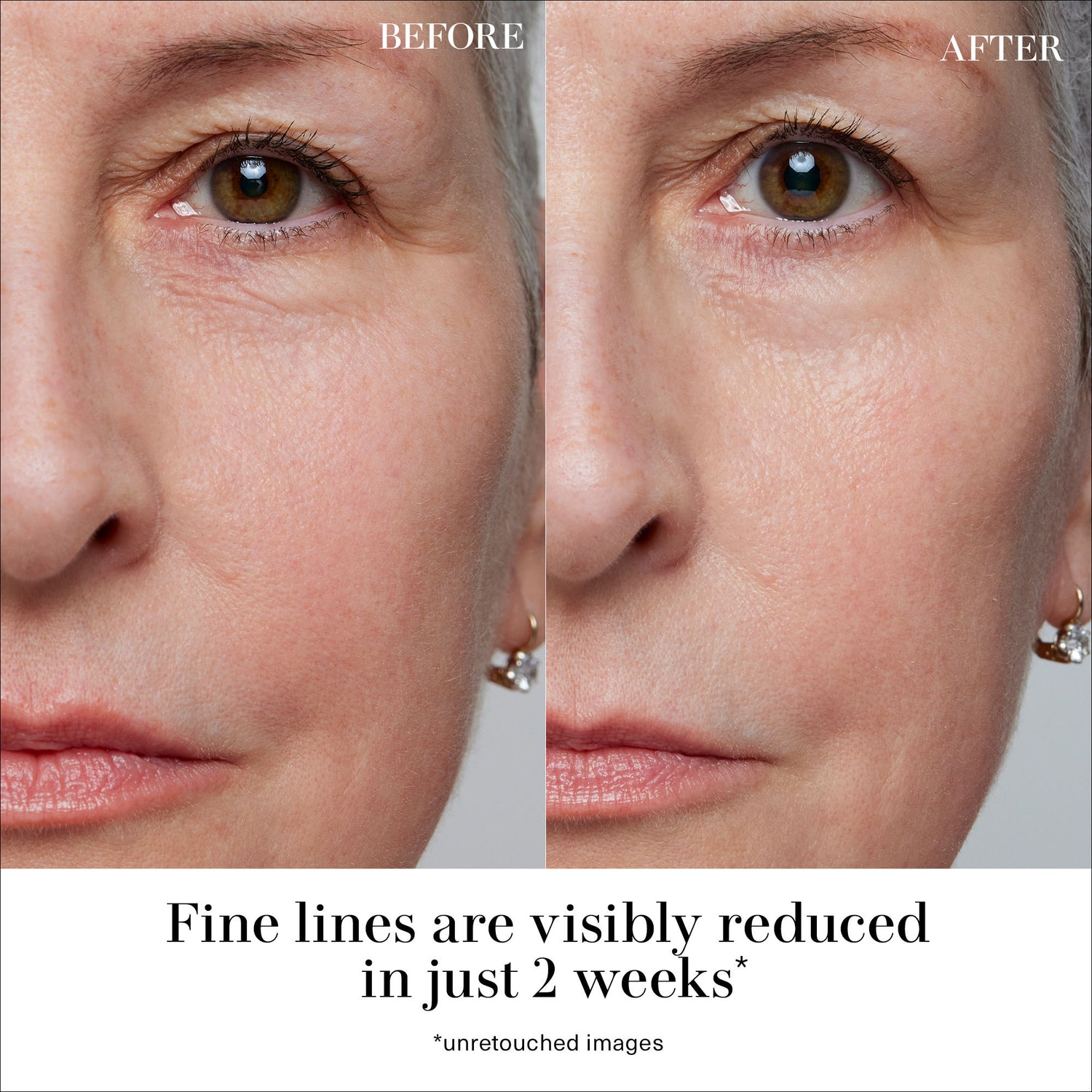 Before and after results of using La Mer Crème de La Mer Face Cream variant: 2 oz