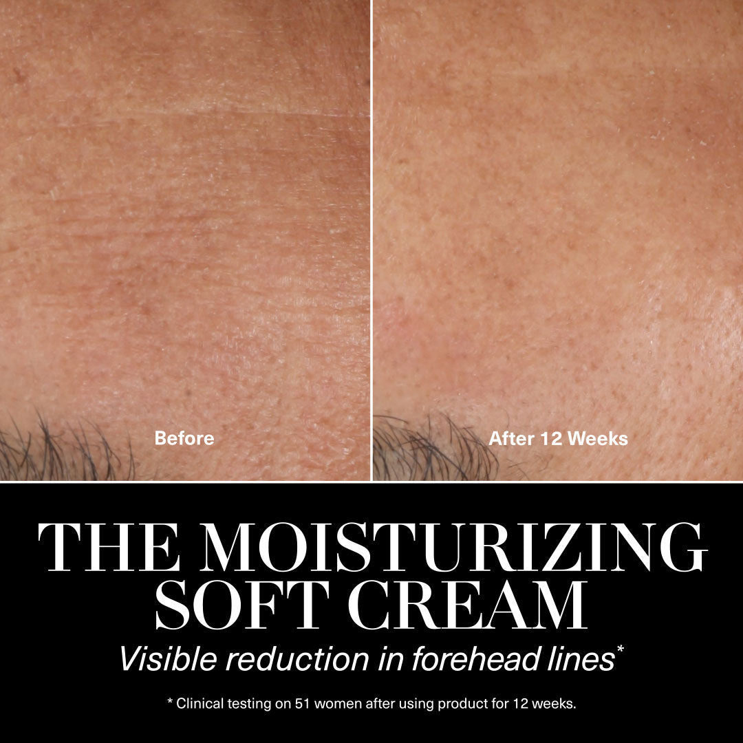 Before and after results of using La Mer The Moisturizing Soft Cream variant: 2 oz