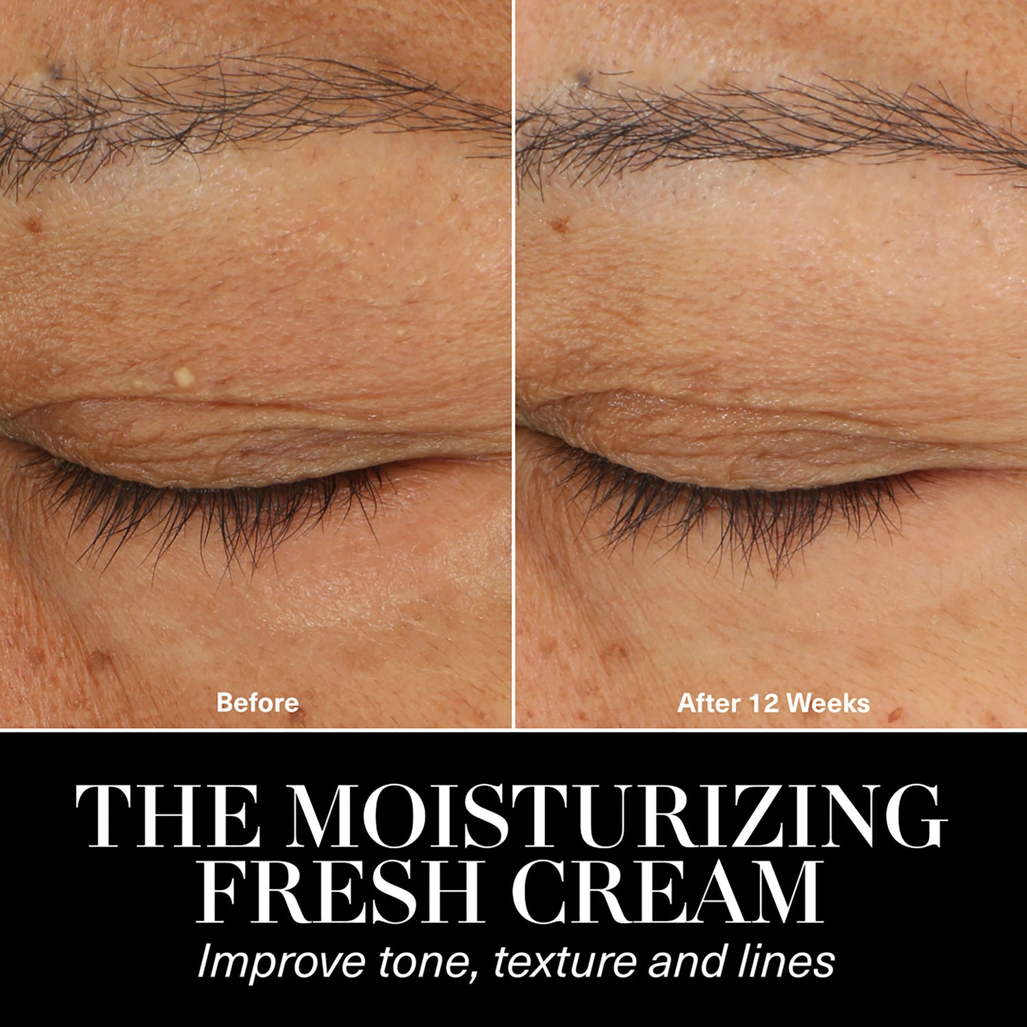 Before and after results of using La Mer The Moisturizing Fresh Cream variant: 2 oz