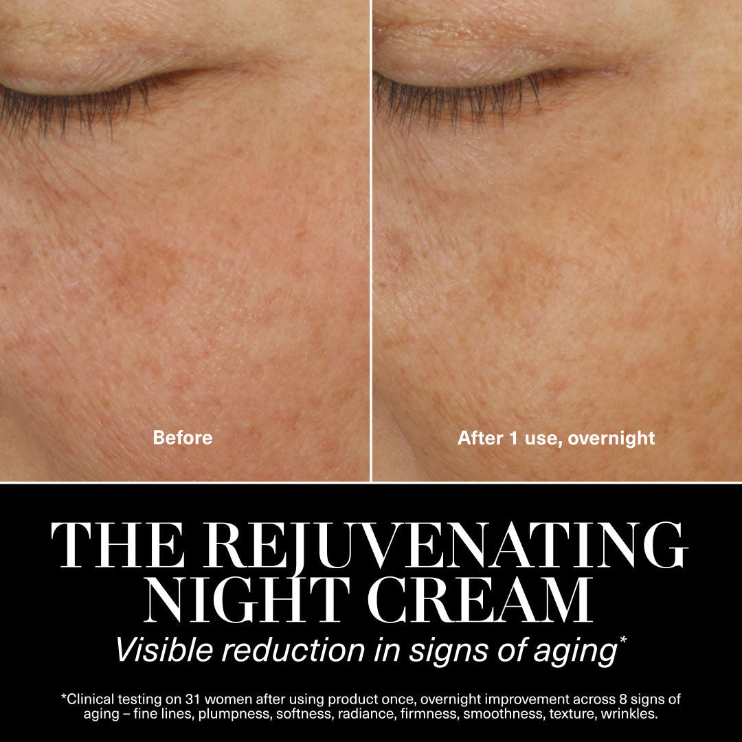 Before and after results of using La Mer The Rejuvenating Night Cream variant: 1 fl oz