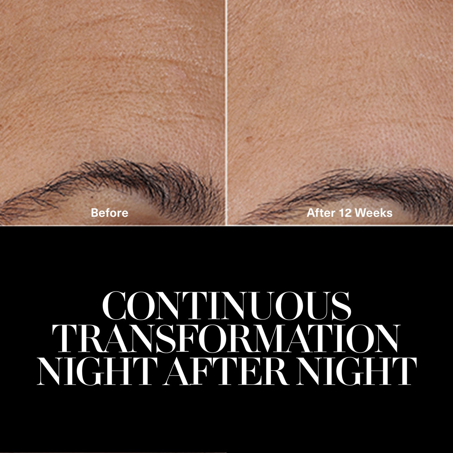 Before and after results of using La Mer The Rejuvenating Night Cream variant: 30 ml