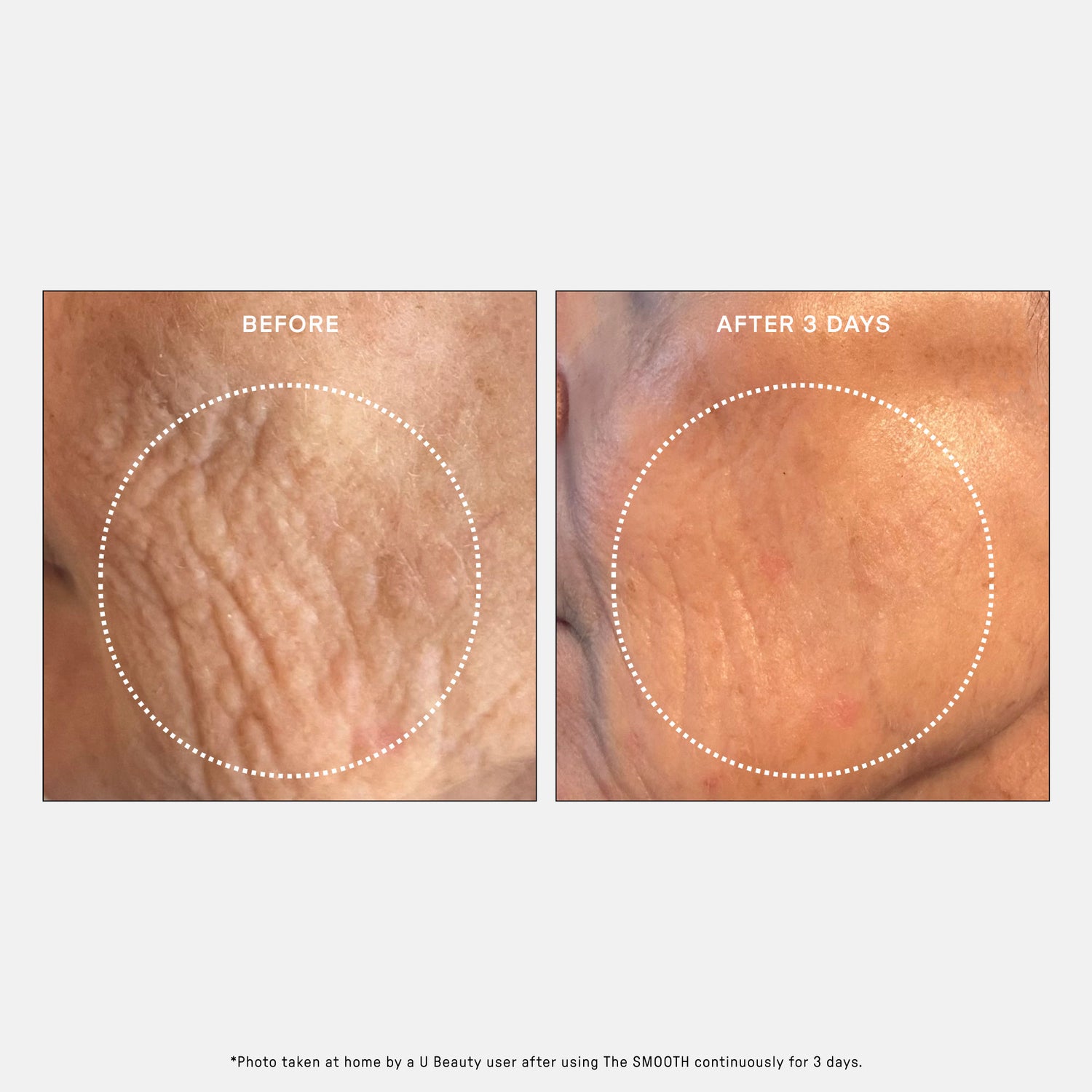 Image of product in the same collection as U Beauty The SMOOTH Dynamic Wrinkle Defense Serum