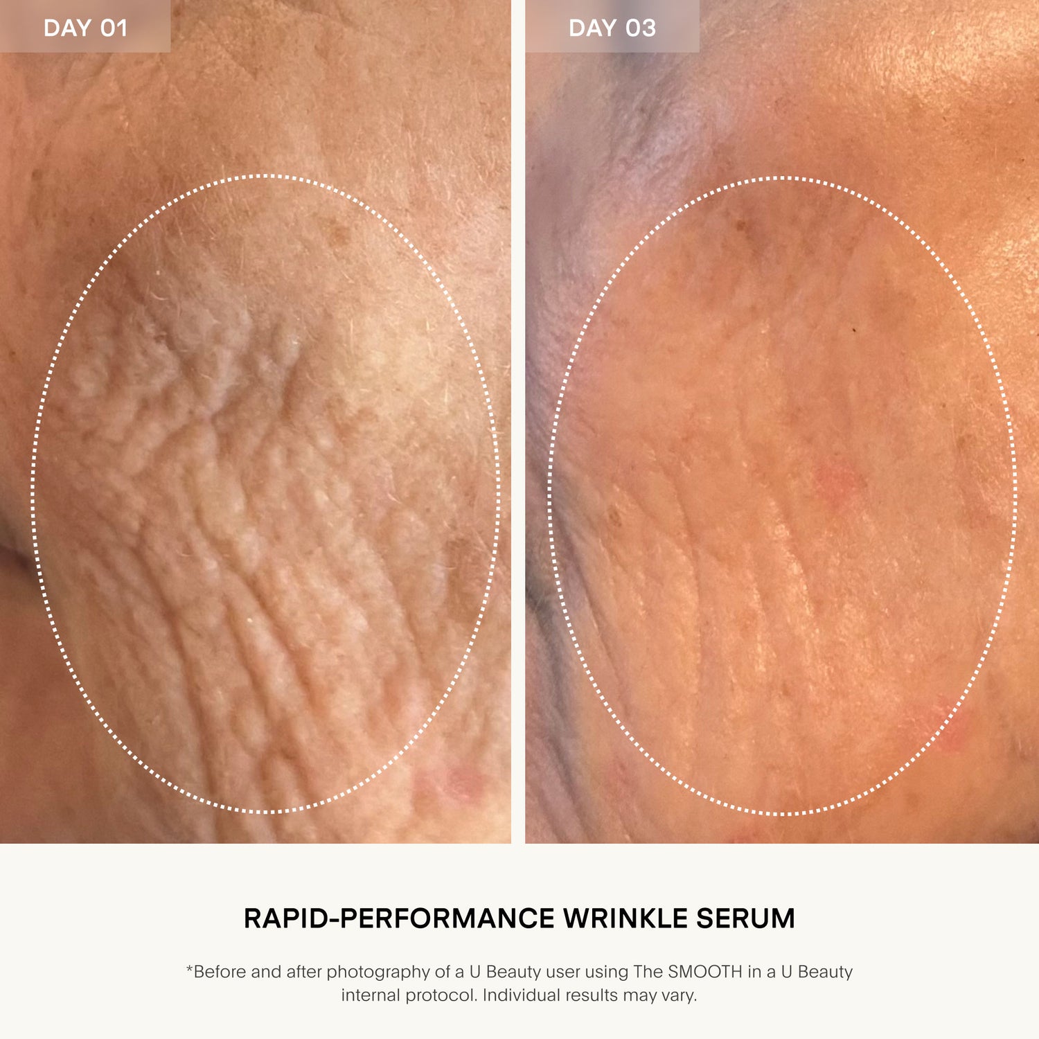 Before and after results of using U Beauty The SMOOTH Dynamic Wrinkle Defense Serum