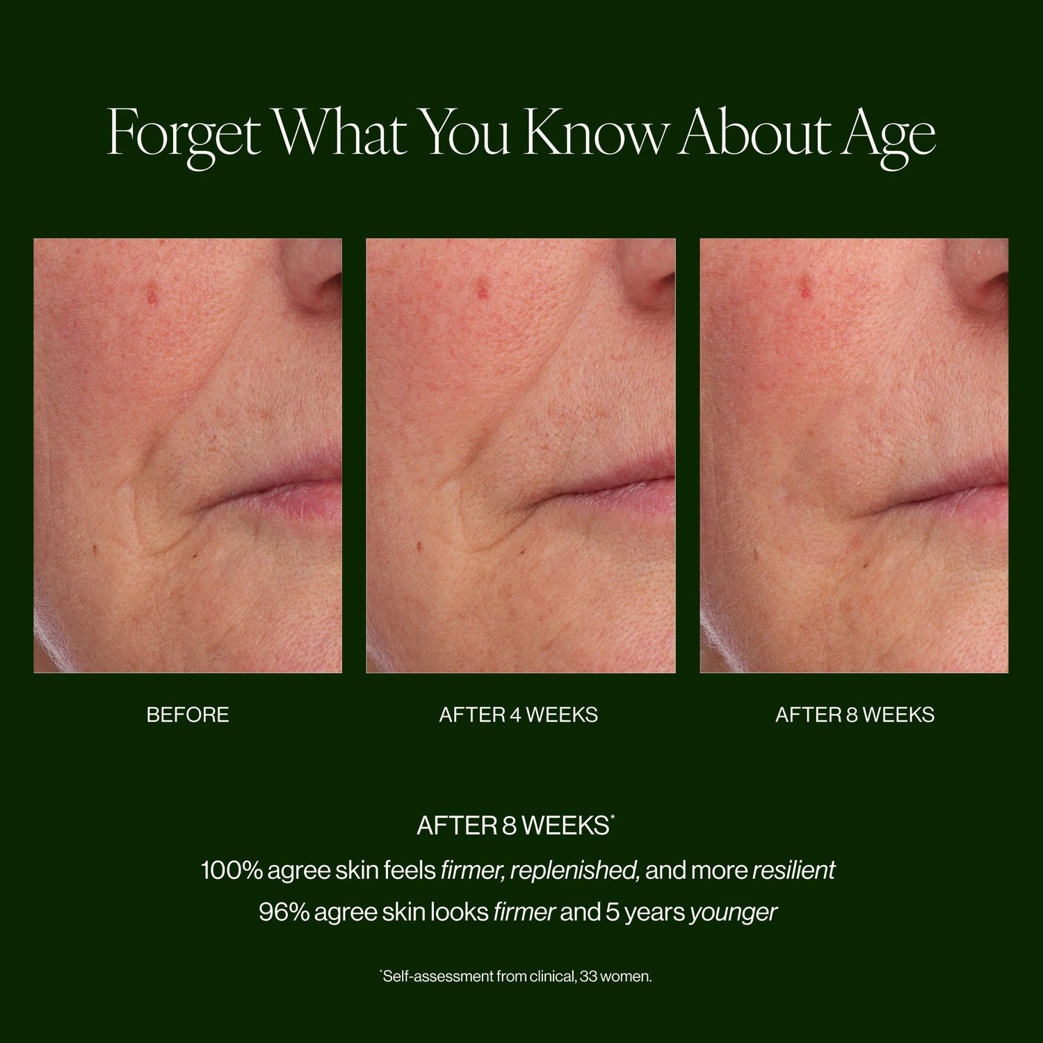 Before and after results of using Tata Harper Crème Supreme