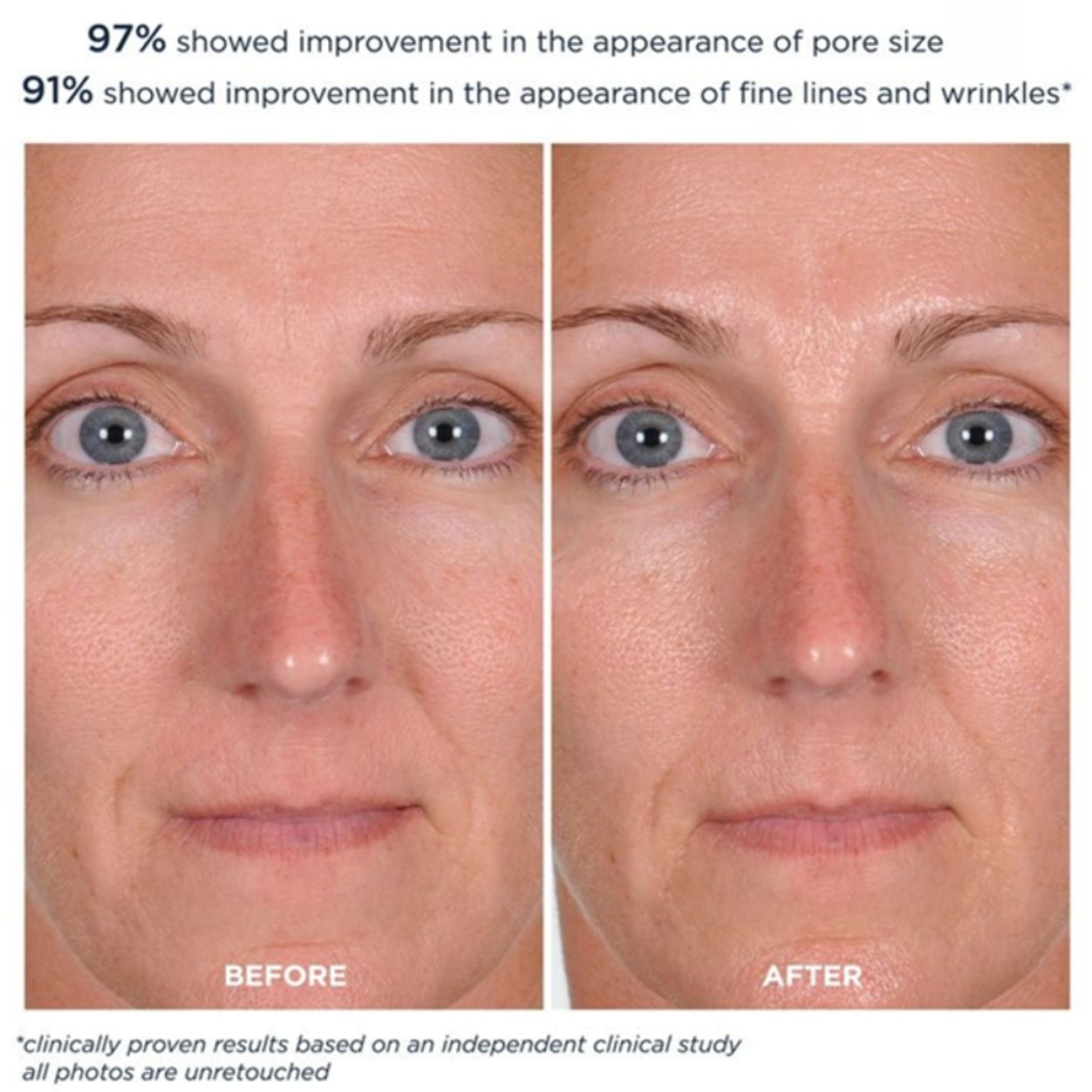 Lifestyle image of M-61 PowerGlow Peel variant: 10 treatments