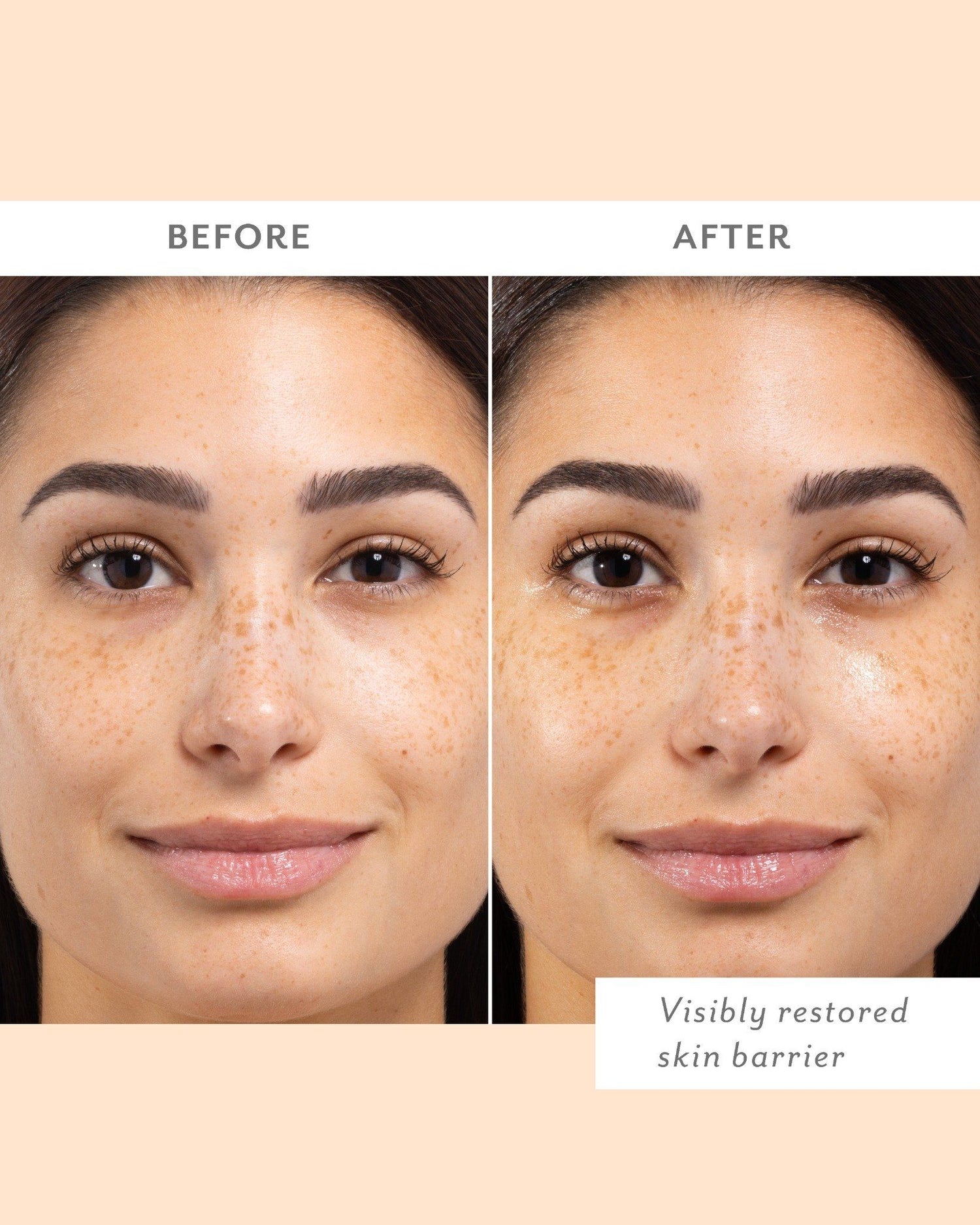 Before and after results of using Patchology Skin Remedy Barrier-Boosting Sheet Mask