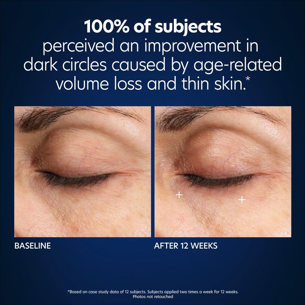 Before and after results of using PCA Skin Hyaluronic Acid Microneedle Eye Patches variant: 1 treatment