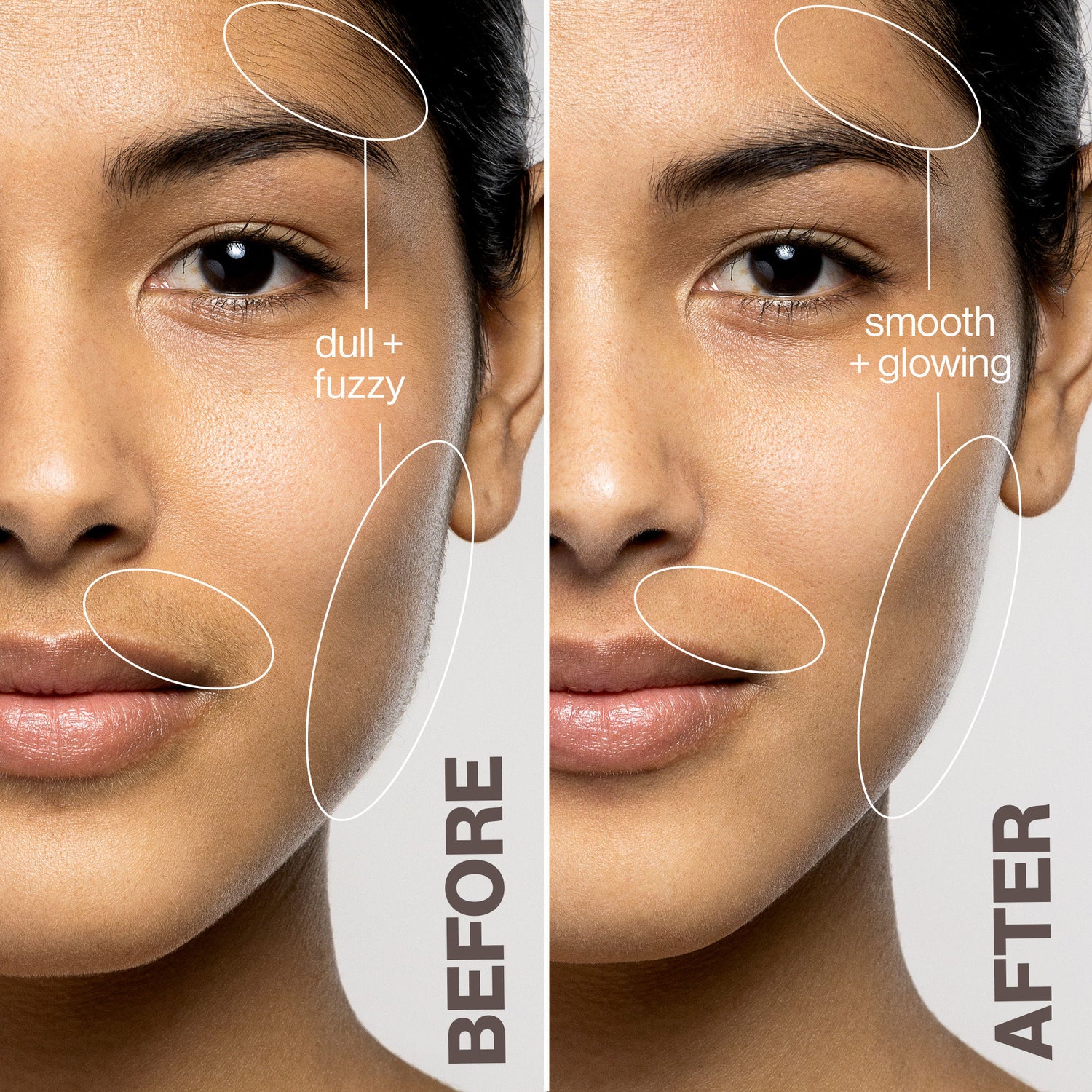 Before and after results of using Dermaflash Luxe+ variant: Blush