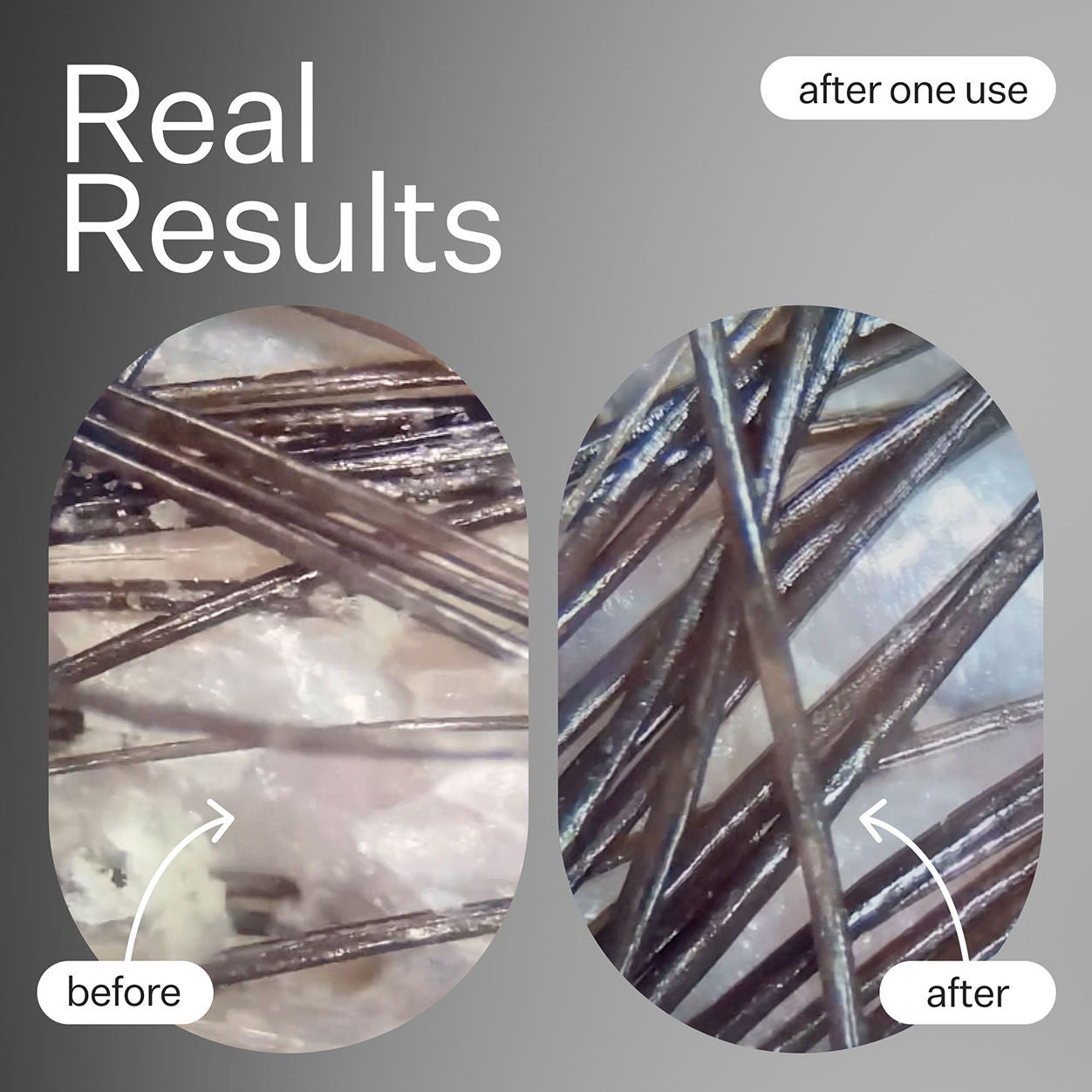 Before and after results of using Act+Acre Cold Processed Hair Cleanse Shampoo variant: 10 fl oz