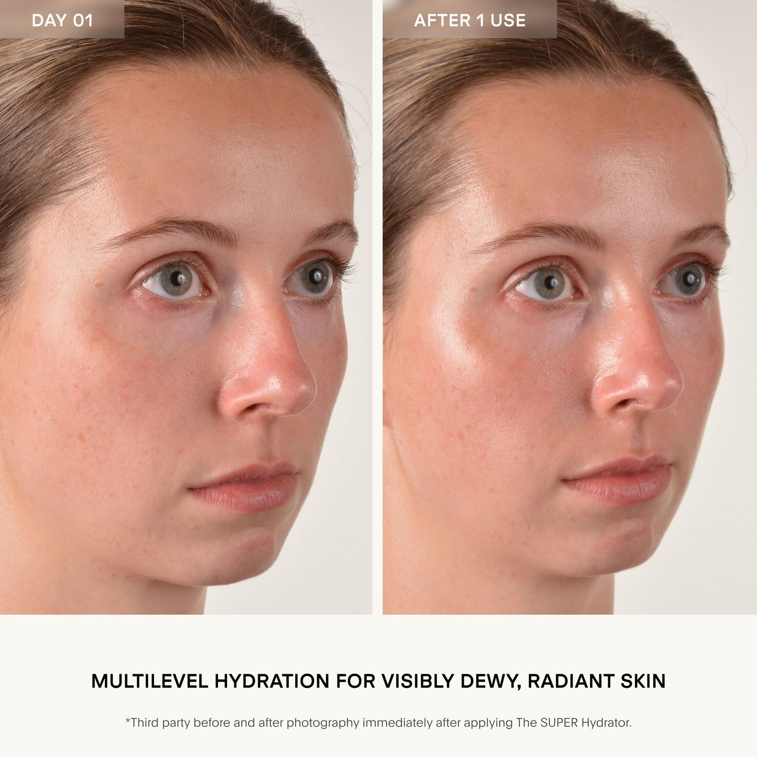 Before and after results of using U Beauty The Super Hydrator