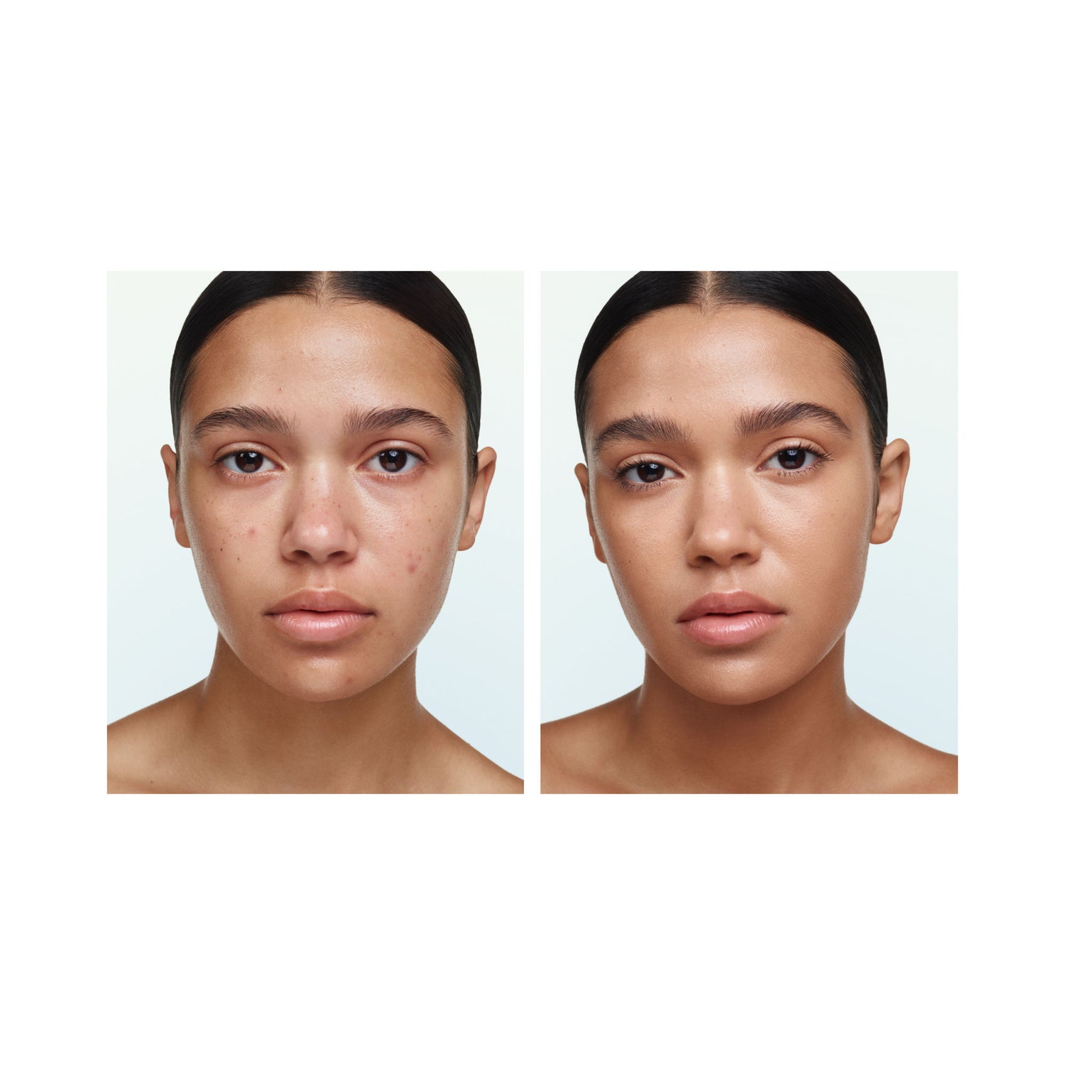Before and after results of using U Beauty Super Tinted Hydrator variant: 07