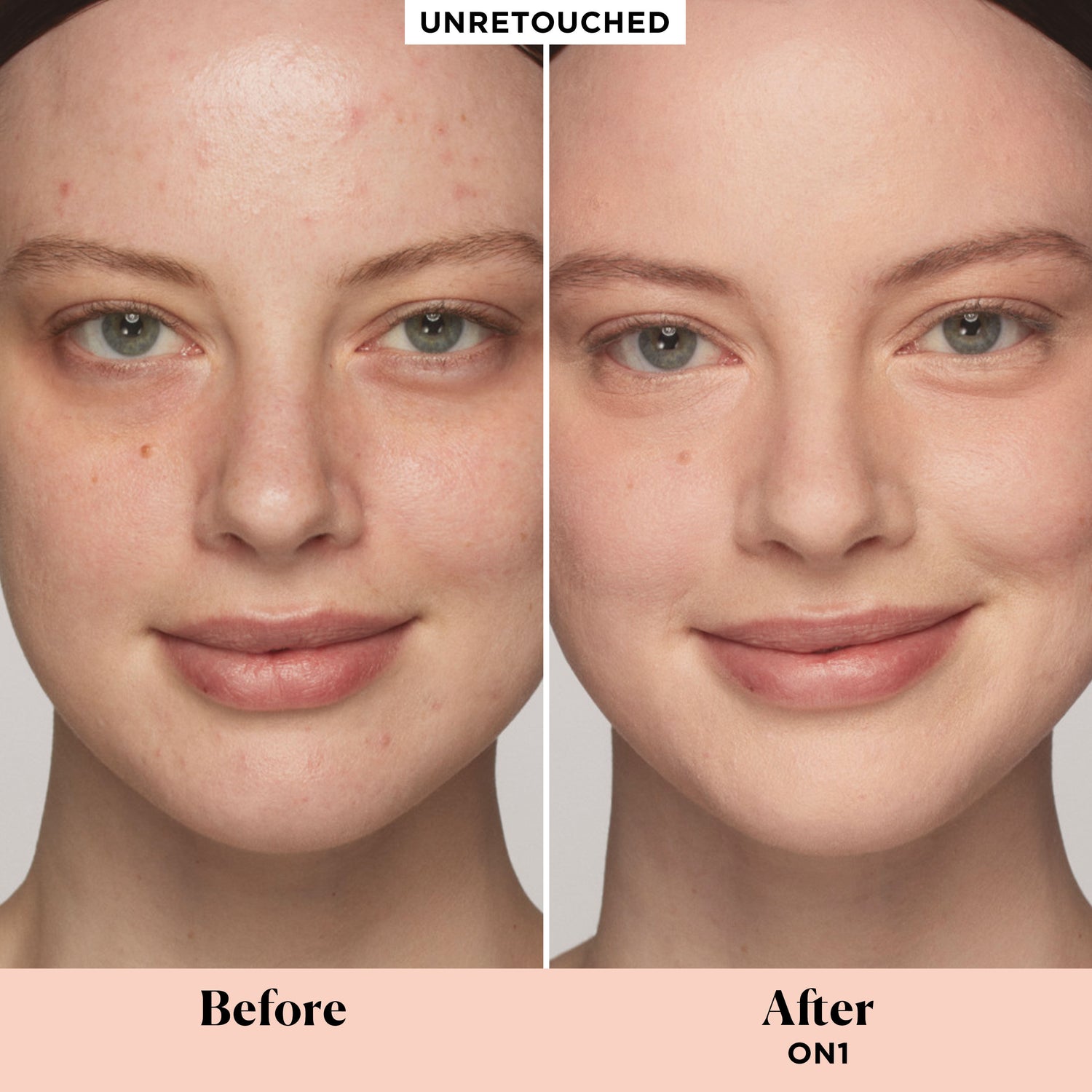 Before and after results of using Laura Mercier Real Flawless Weightless Perfecting Concealer variant: 0N1