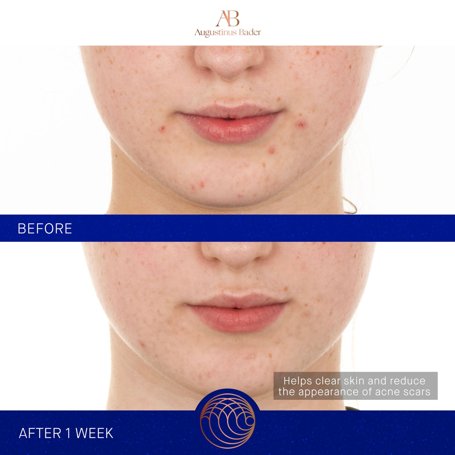 Before and after results of using Augustinus Bader The Retinol Serum variant: 1.7 oz
