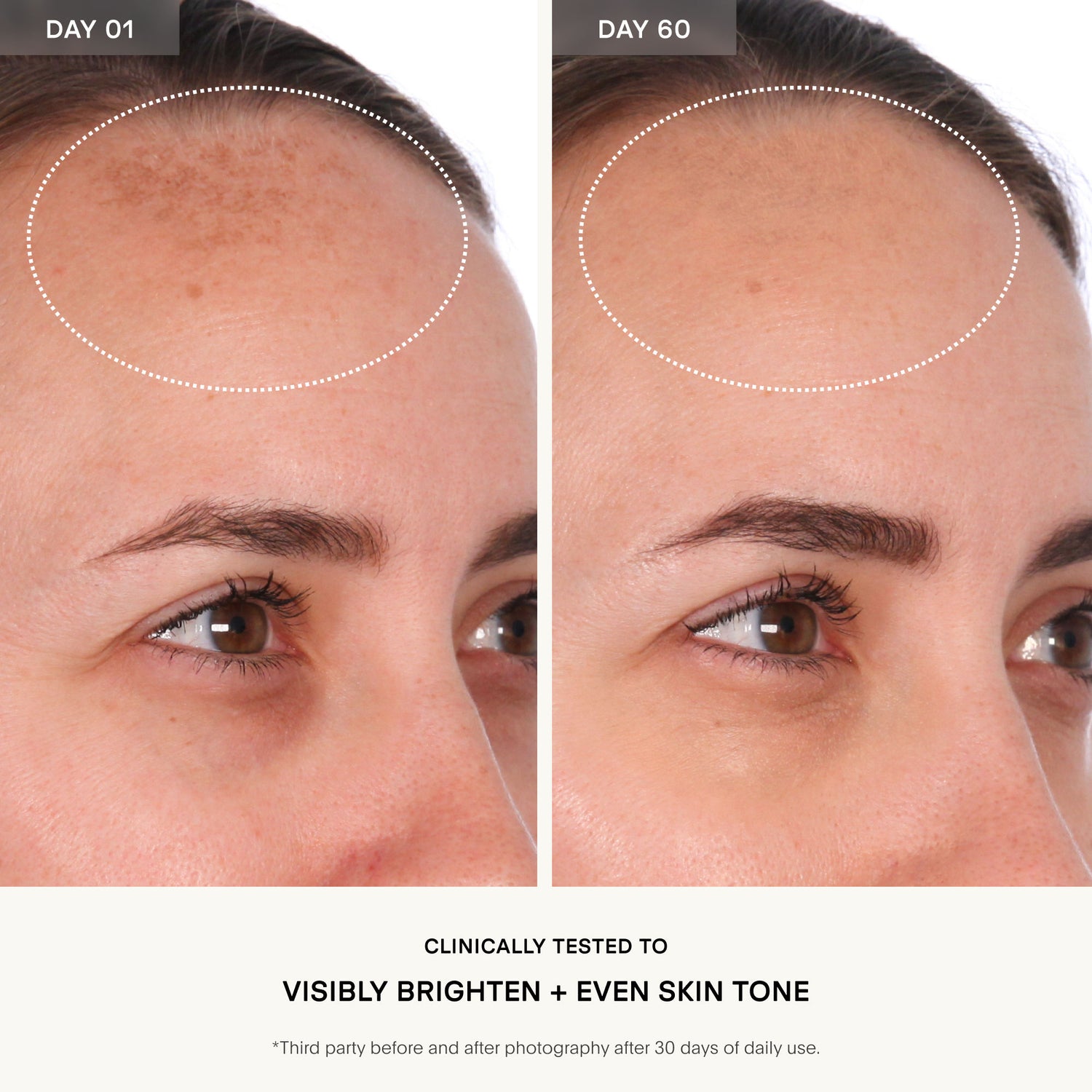 Before and after results of using variant: 1.7 oz