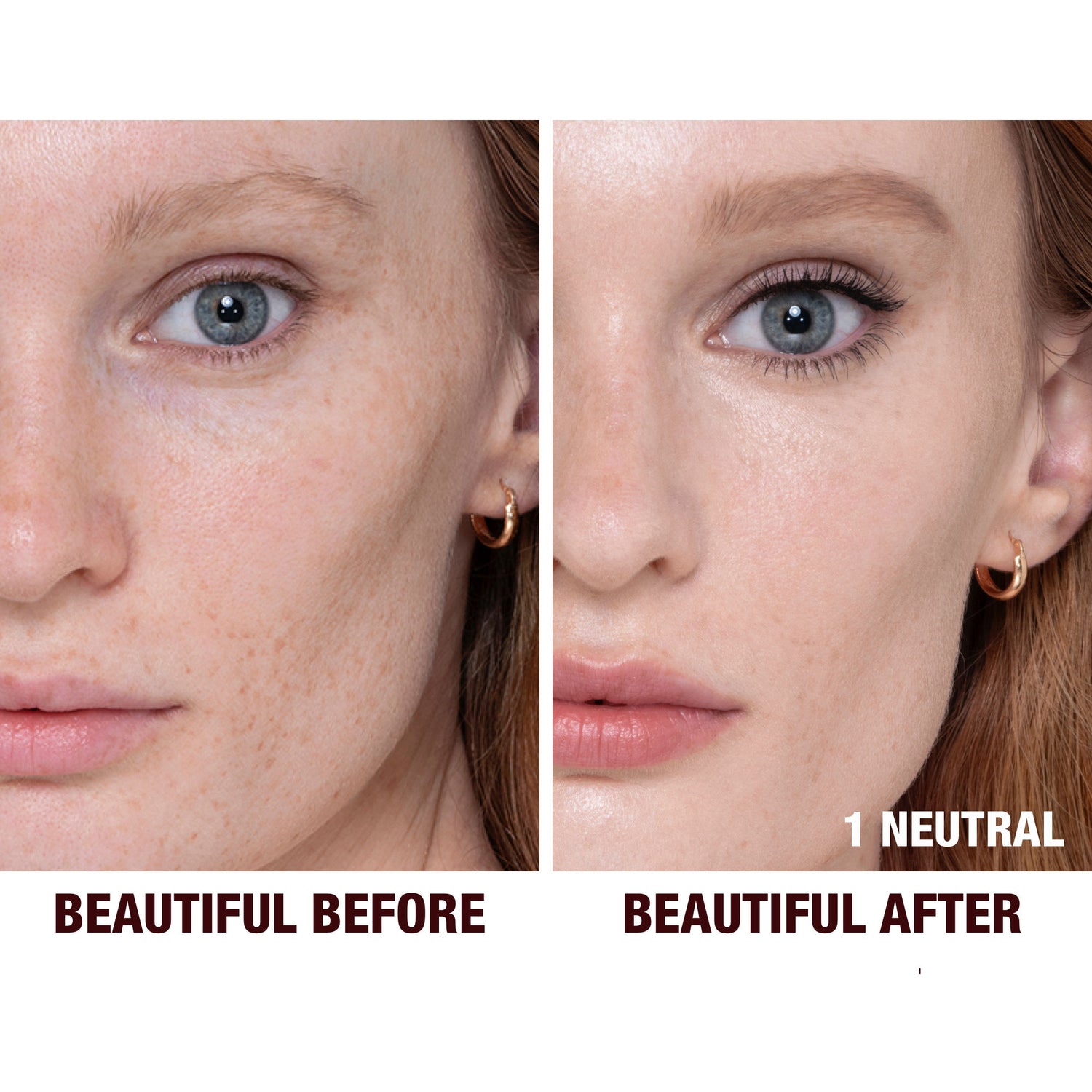 Before and after results of using Charlotte Tilbury 1 Neutral (fair with neutral undertones) variant: 1 Neutral (fair with neutral undertones)