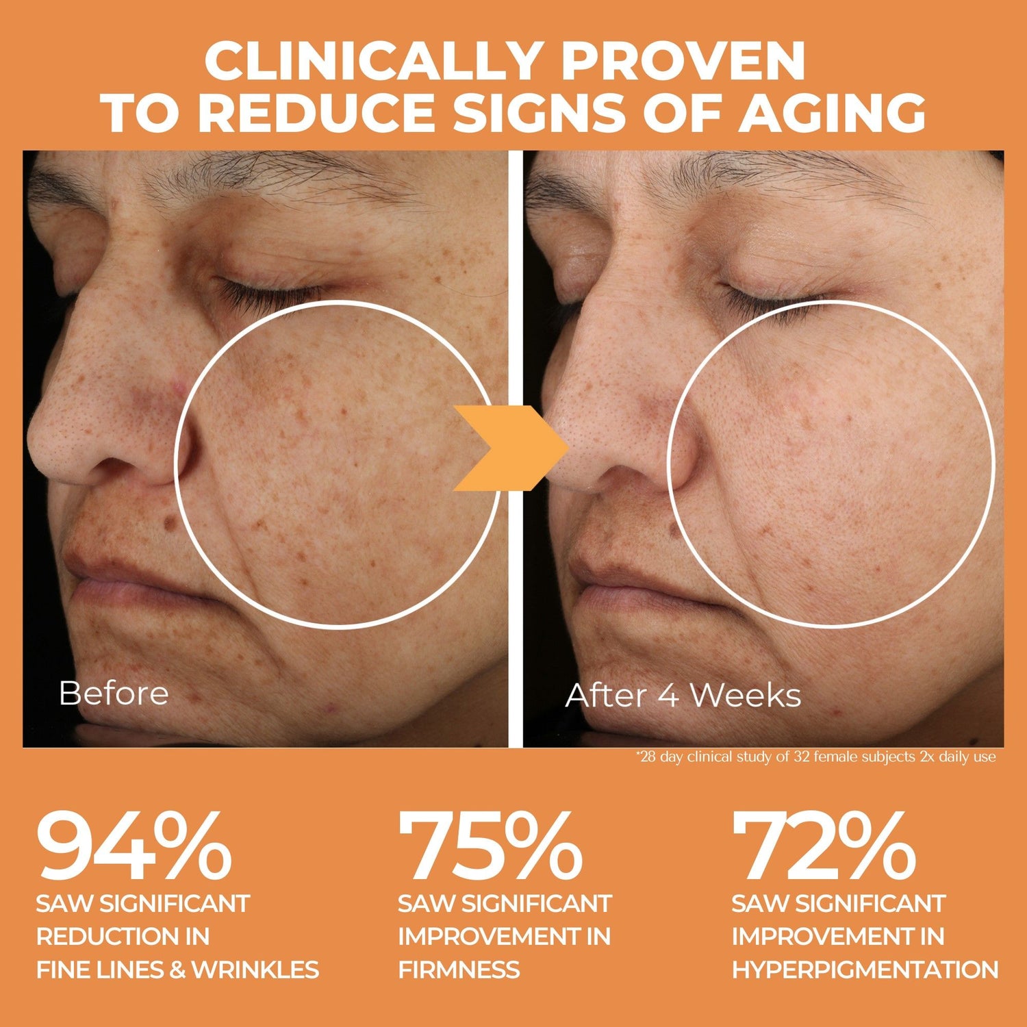 Before and after results of using BeautyStat Universal C Skin Refiner variant: 1 fl oz