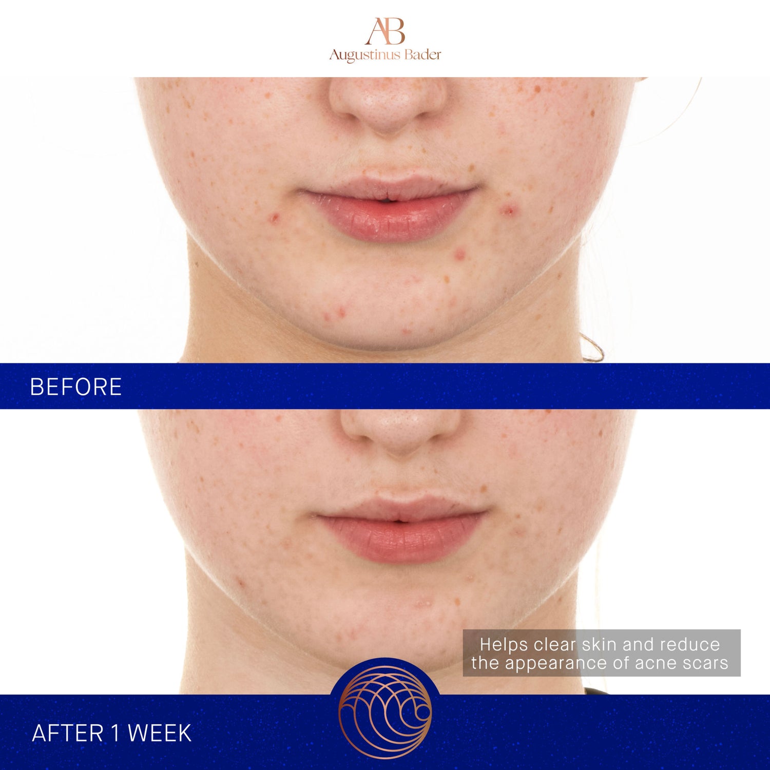 Before and after results of using Augustinus Bader The Retinol Serum variant: 1 oz