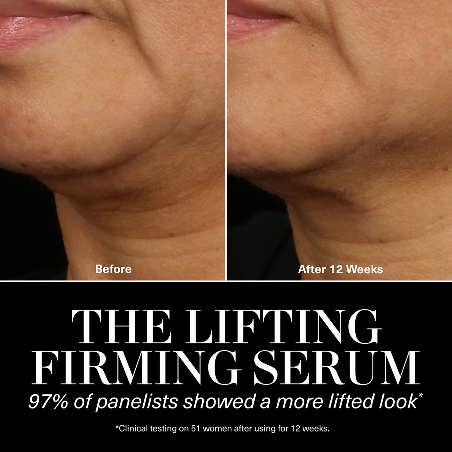 Before and after results of using La Mer The Lifting Firming Serum variant: 1 oz
