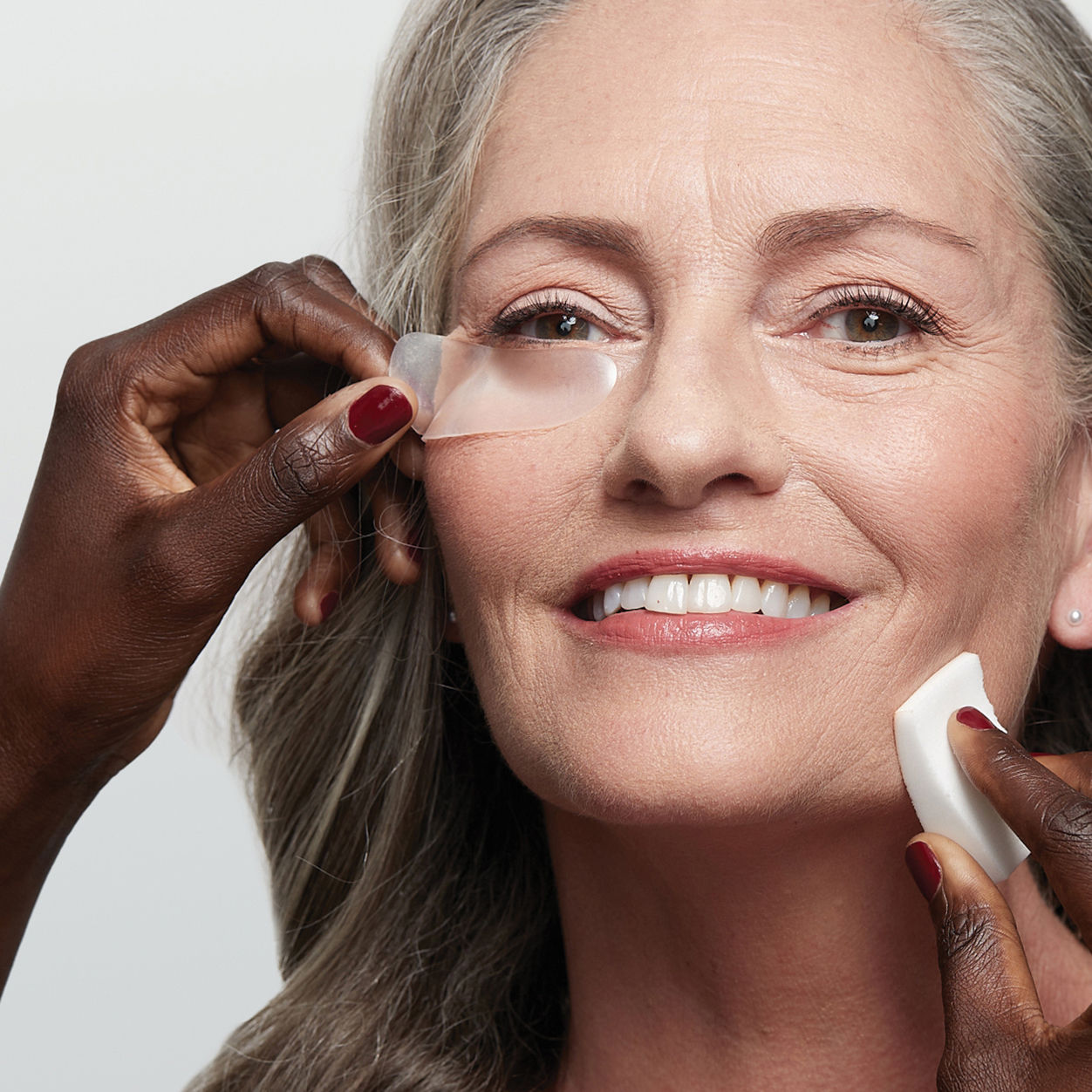 Model image of SIO Eye and Smile Lift variant: 2 Treatments