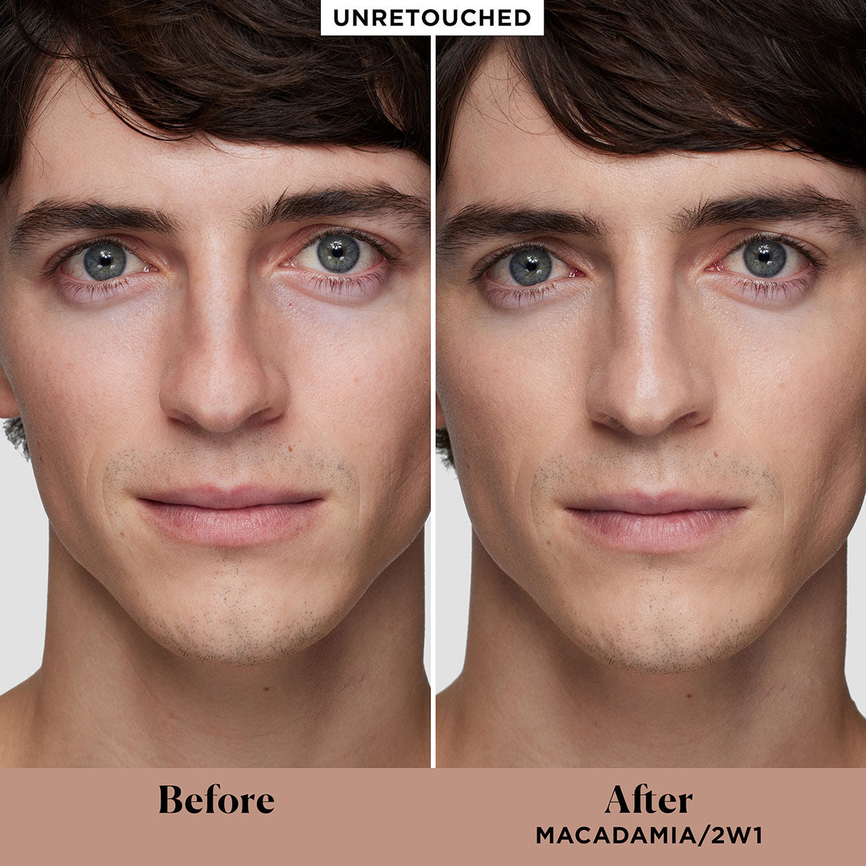 Before and after results of using variant: 2W1 Macadamia