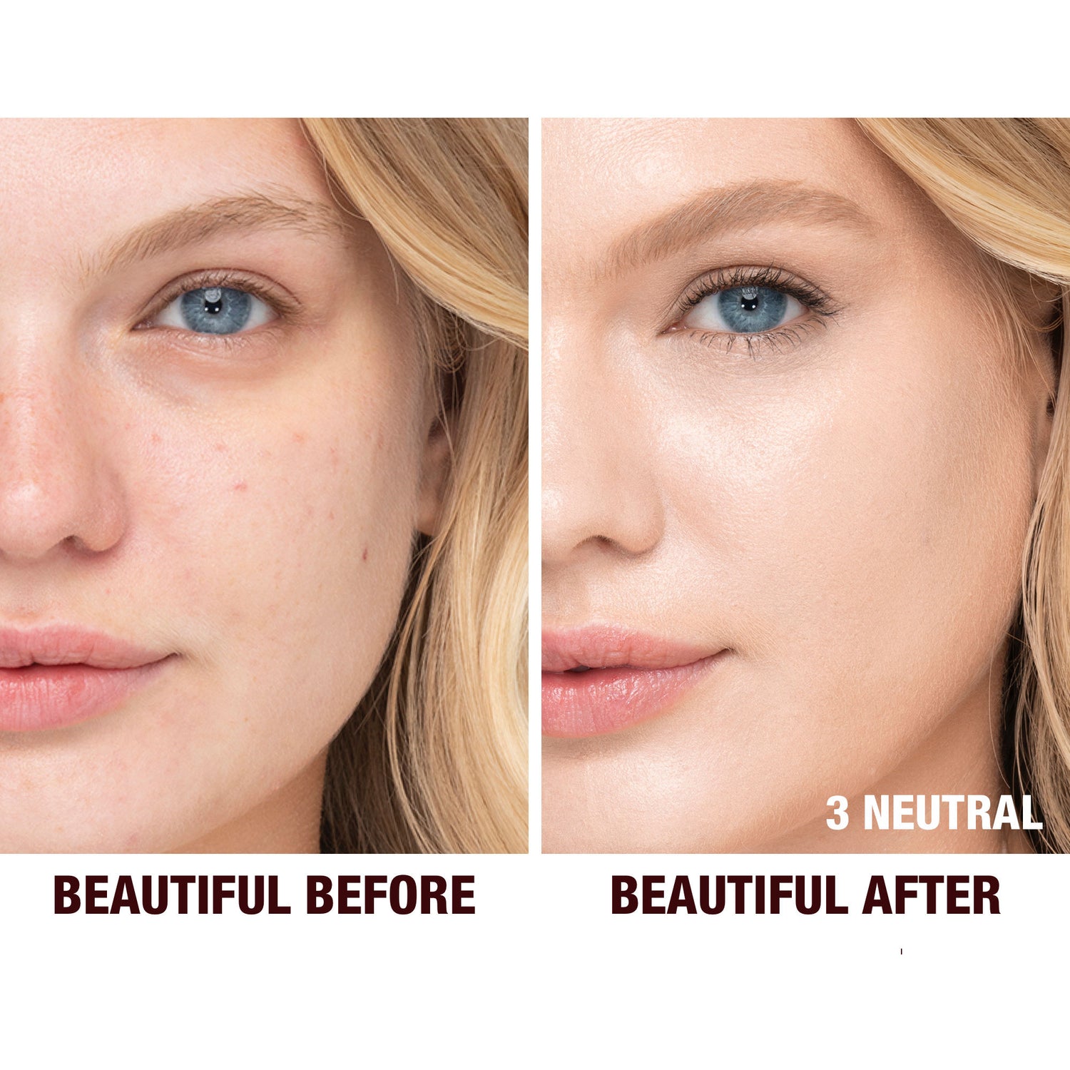 Before and after results of using Charlotte Tilbury Charlotte's Beautiful Skin Foundation variant: 3 Neutral (fair with neutral undertones)