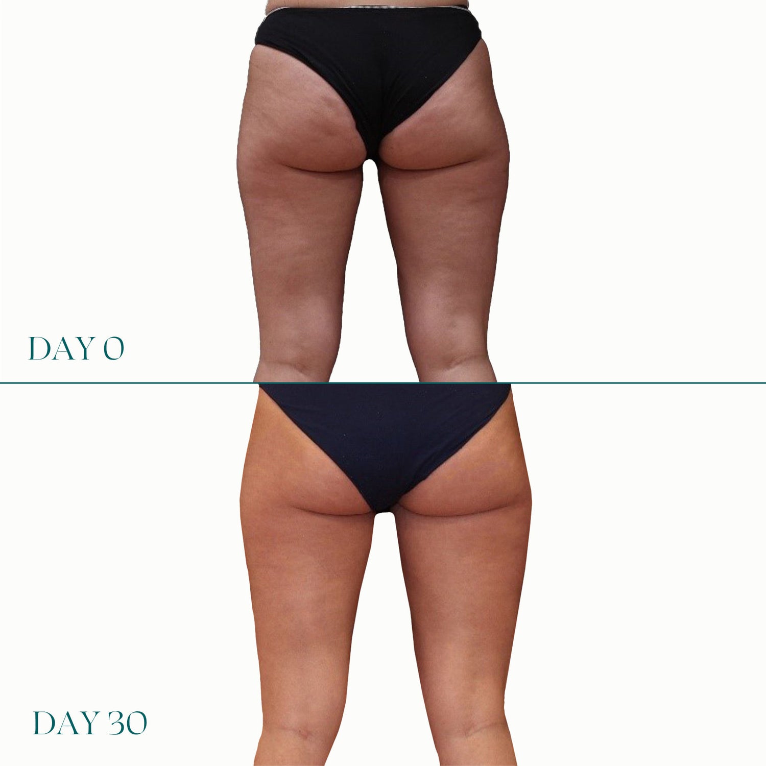Before and after results of using Legology Air-Lite Daily Lift For Legs variant: 6 oz