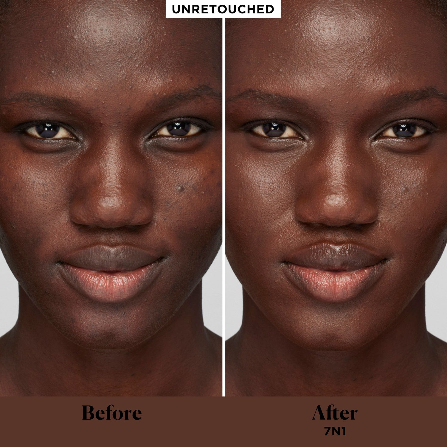 Before and after results of using Laura Mercier Real Flawless Weightless Perfecting Concealer variant: 7N1