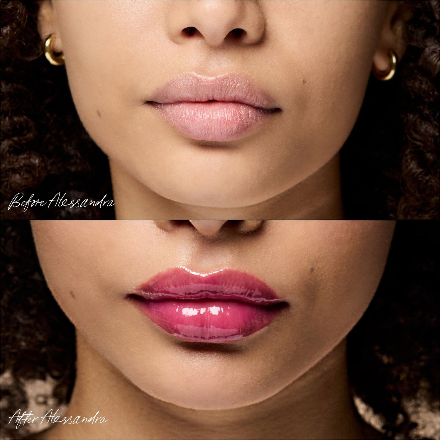 Before and after results of using RMS Beauty Legendary Lip Oil variant: Alessandra