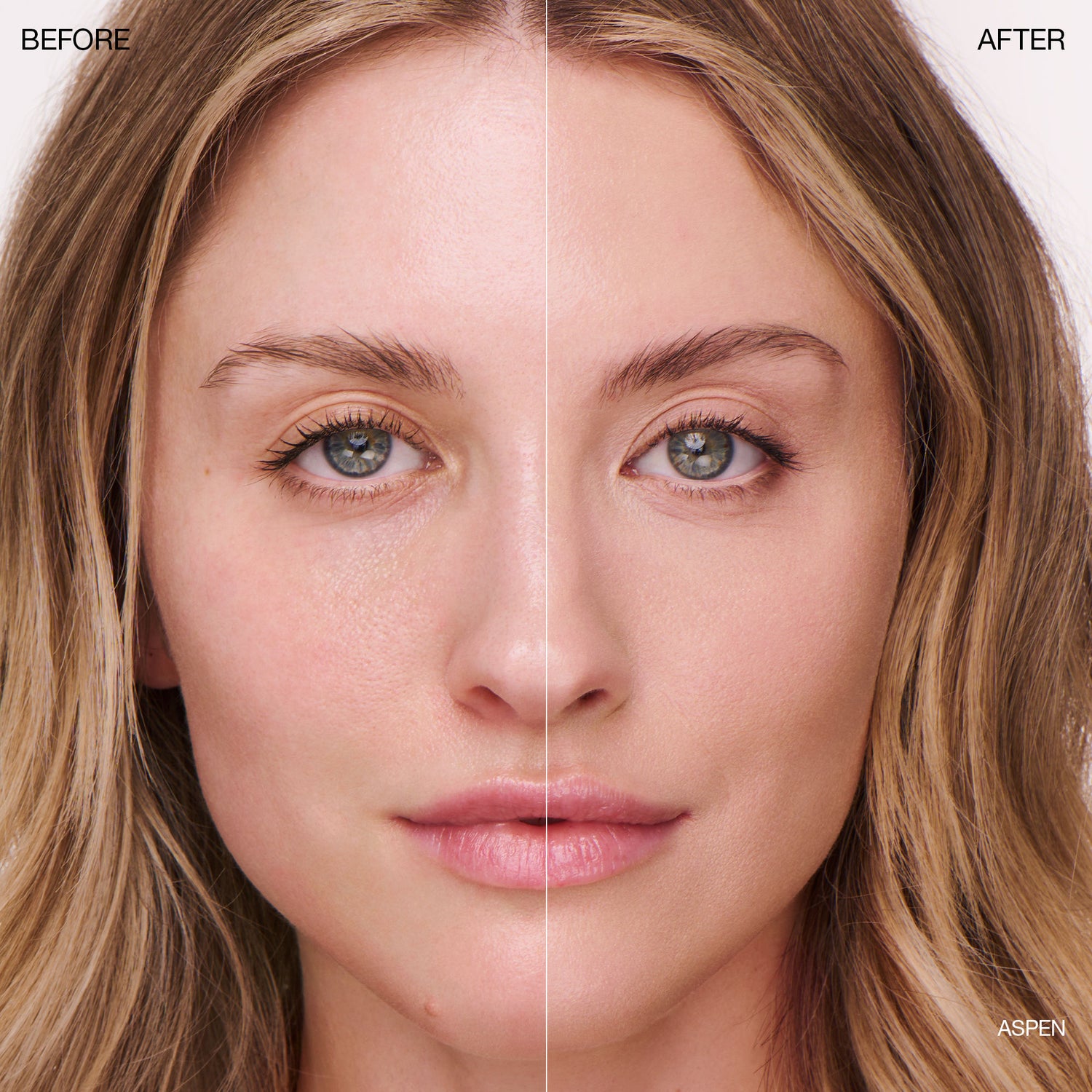 Before and after results of using Ogee Complexion Perfecting Tinted Serum variant: Aspen - 1.0W