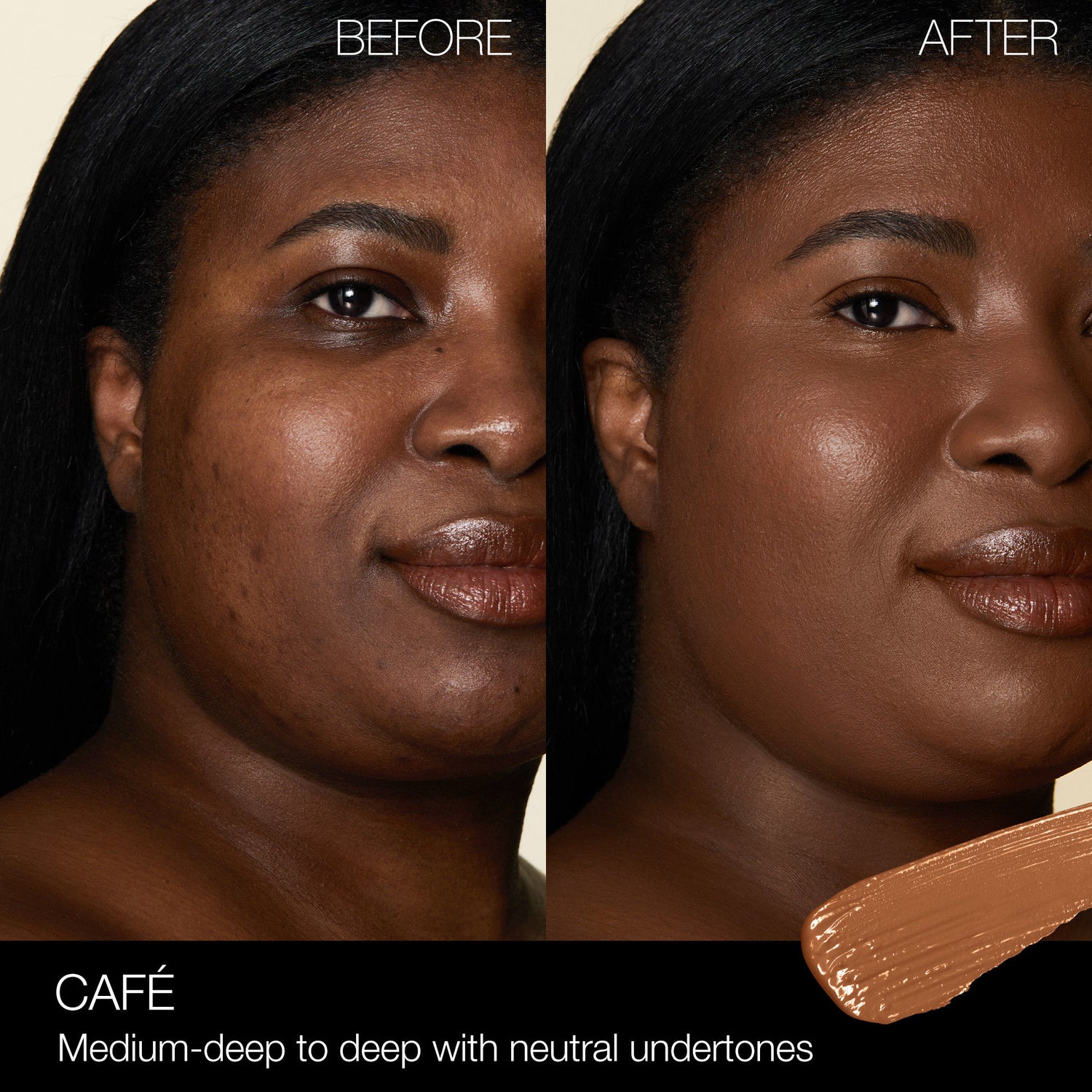 Before and after results of using Nars Radiant Creamy Concealer variant: Café D1