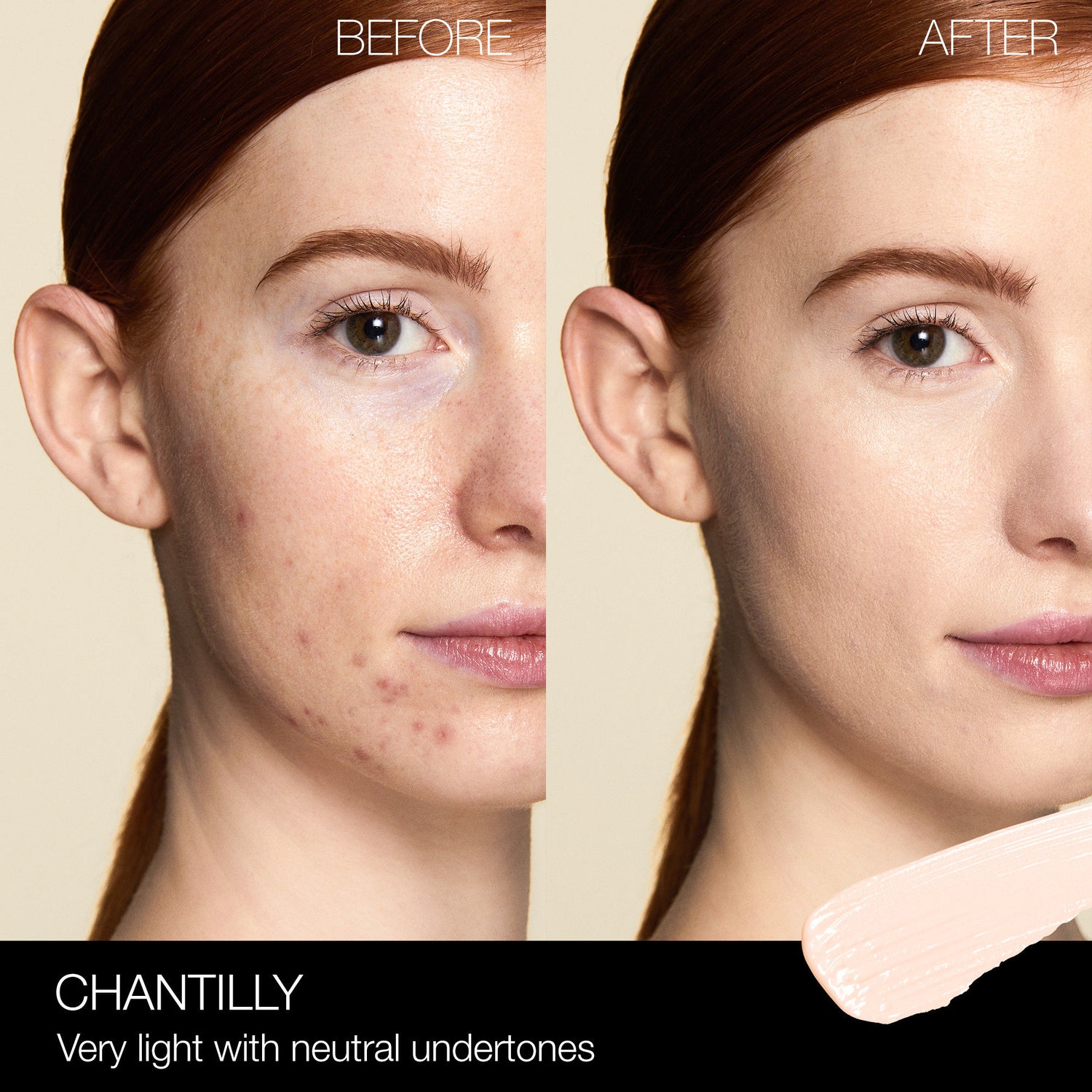 Before and after results of using Nars Radiant Creamy Concealer variant: Chantilly L1