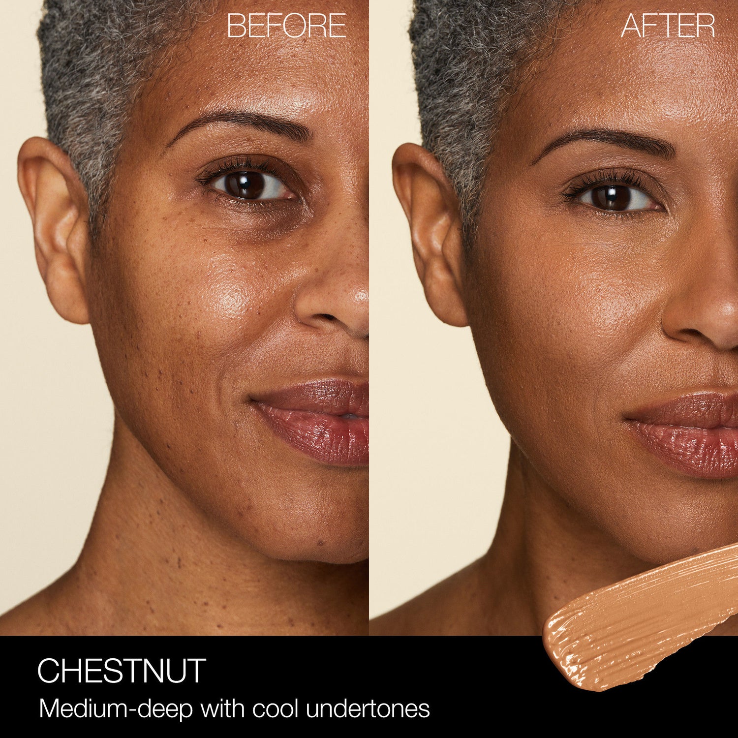Before and after results of using Nars Radiant Creamy Concealer variant: Chestnut MD2.5